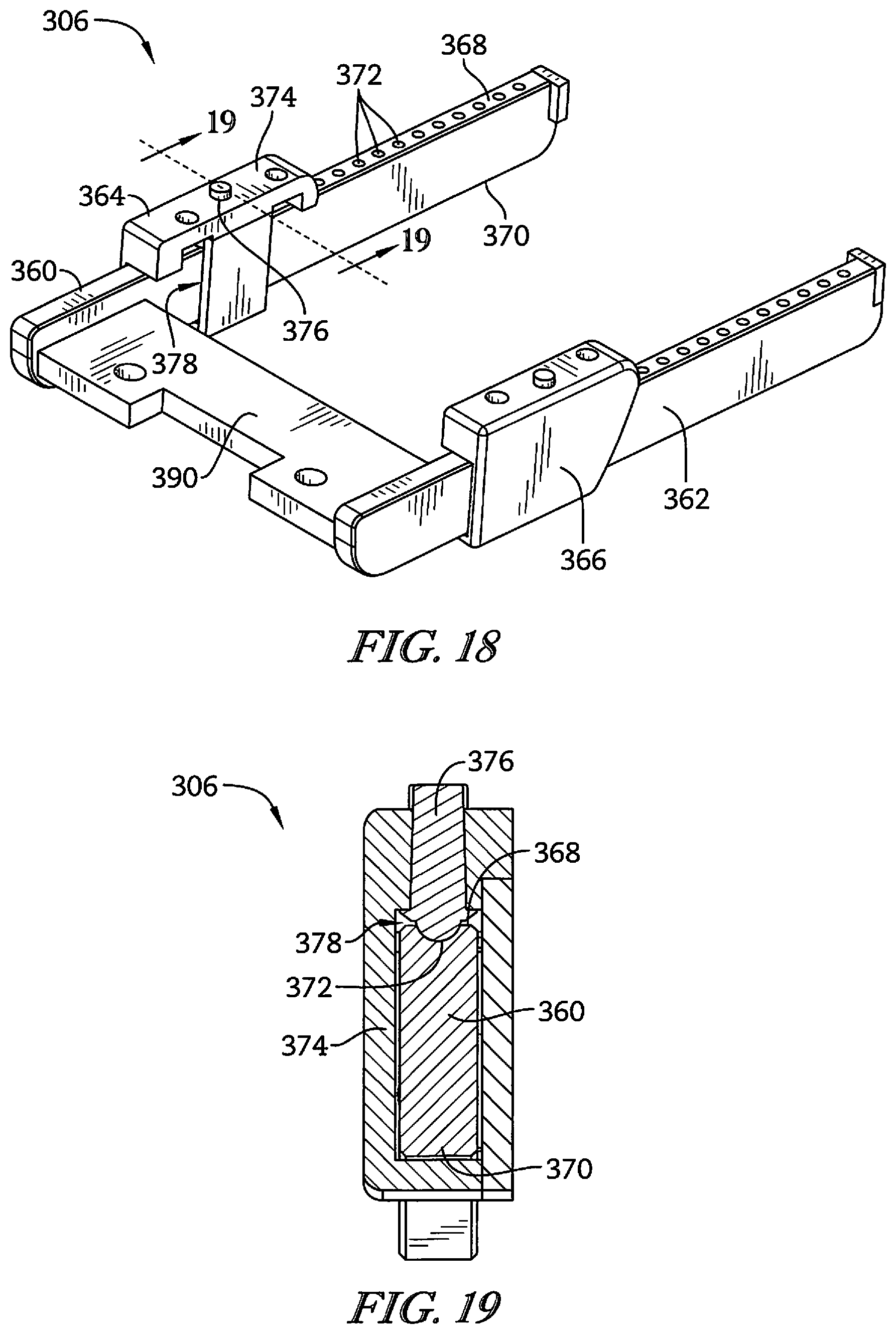 Patent US12102571 Figure 11 – Releasable spar for surgical boot