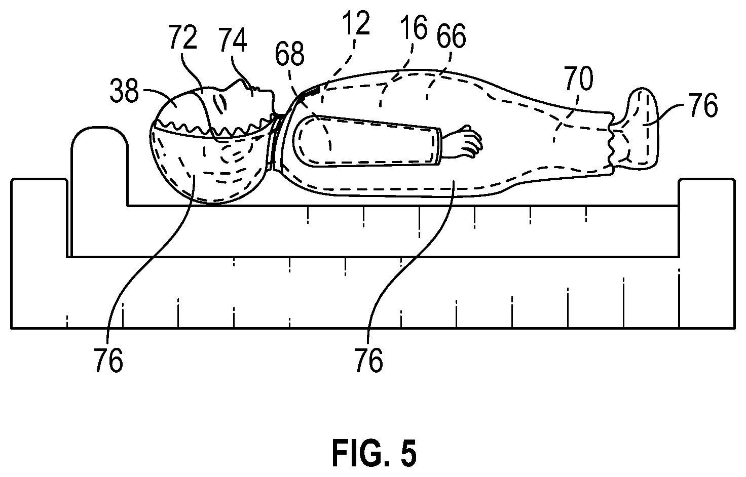 Patent US12102572 Figure 4 – Mortuary undergarment assembly