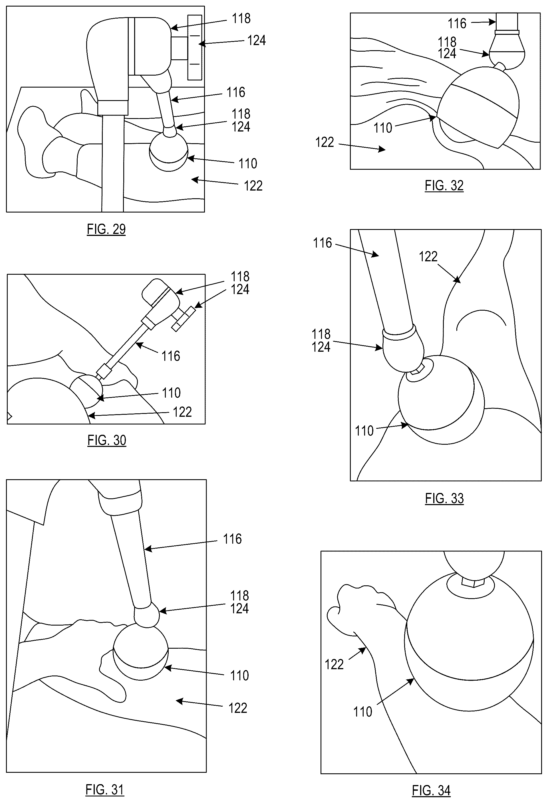 Patent US12102581 Figure 9 – Treatment force application device