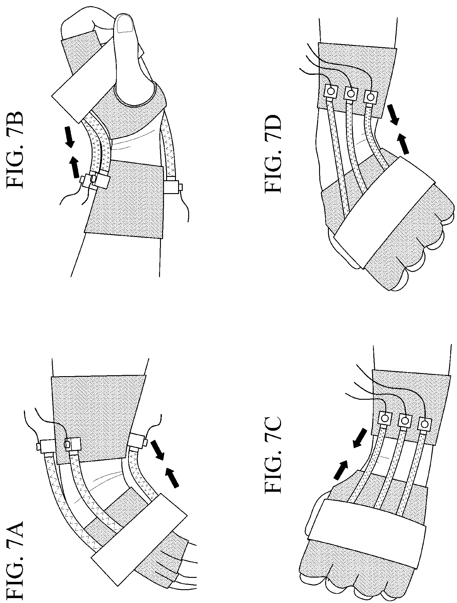 Patent US12102585 Figure 7 – Wearable robot for assisting upper limb movement by using artificial muscle