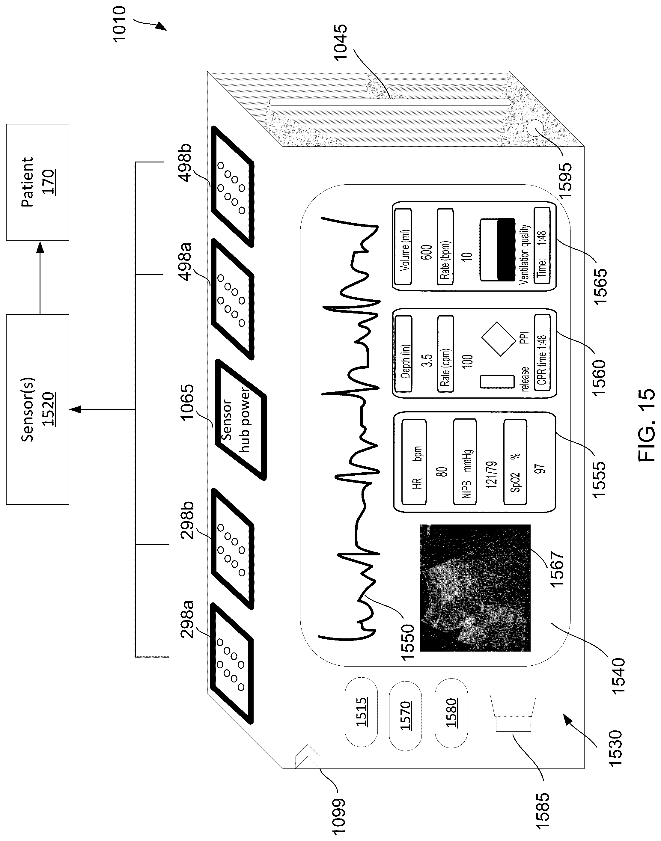 Patent US12102590 Figure 17 – Medical device system and hardware for sensor data acquisition