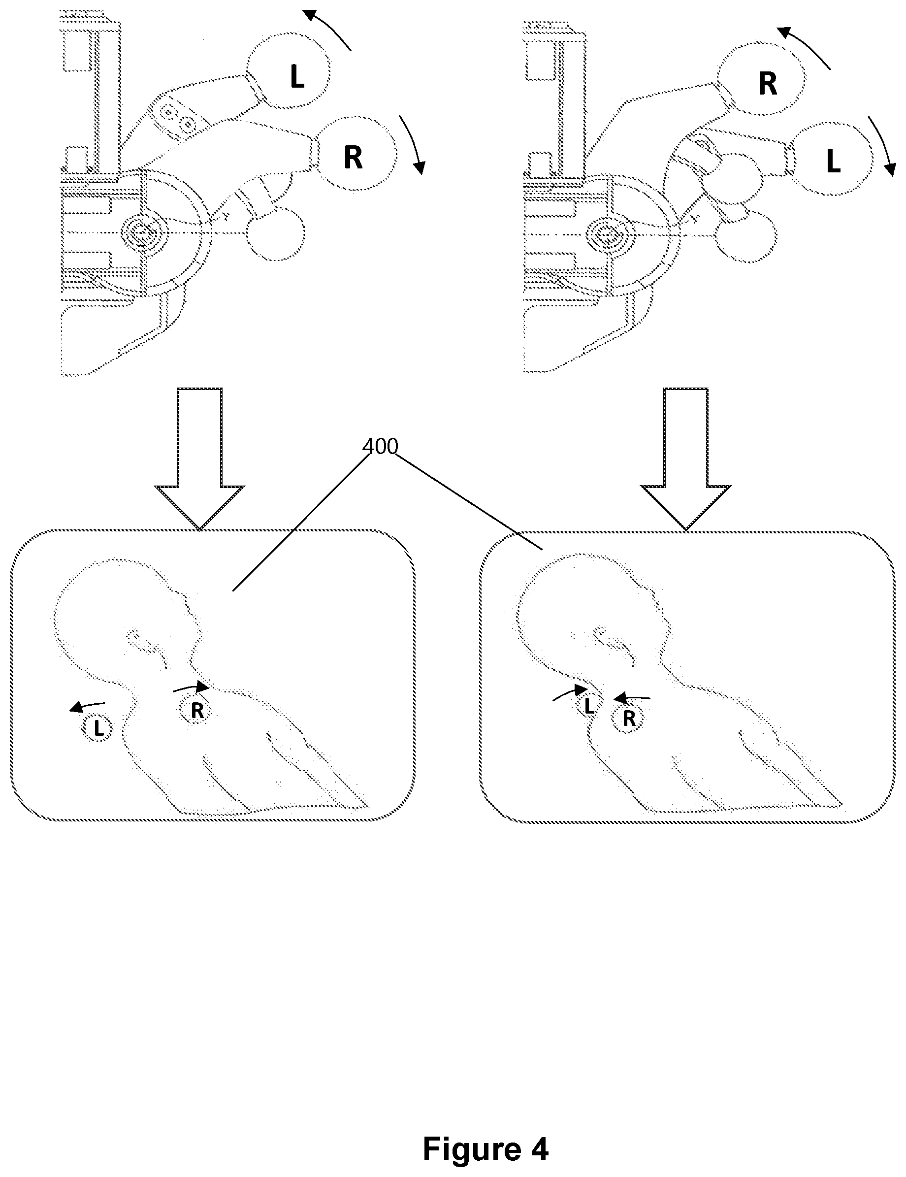 Patent US12102591 Figure 4 – System and method for controlling a massage apparatus