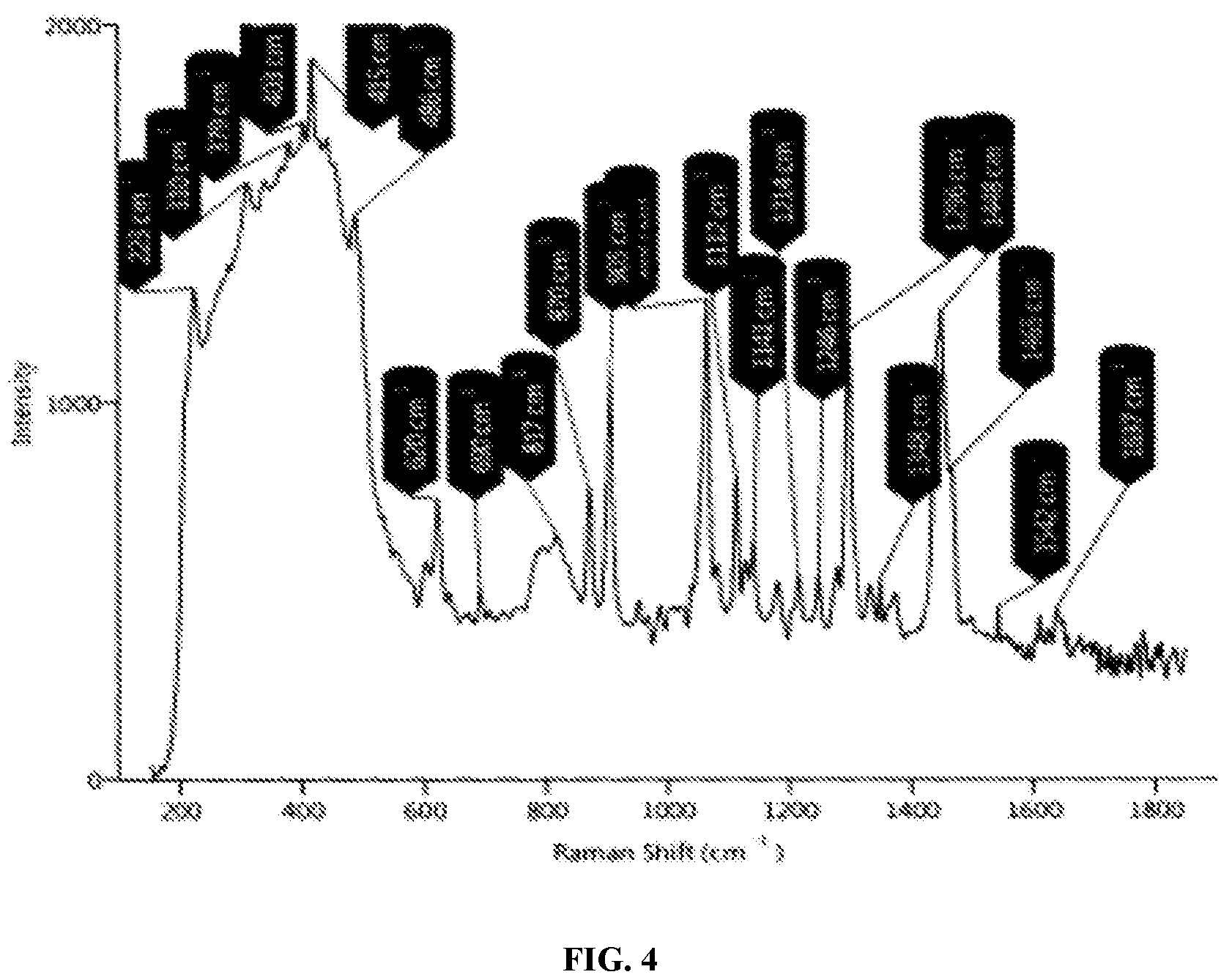 Patent US12102594 Figure 4 – Infusion bag of Midazolam for intravenous use