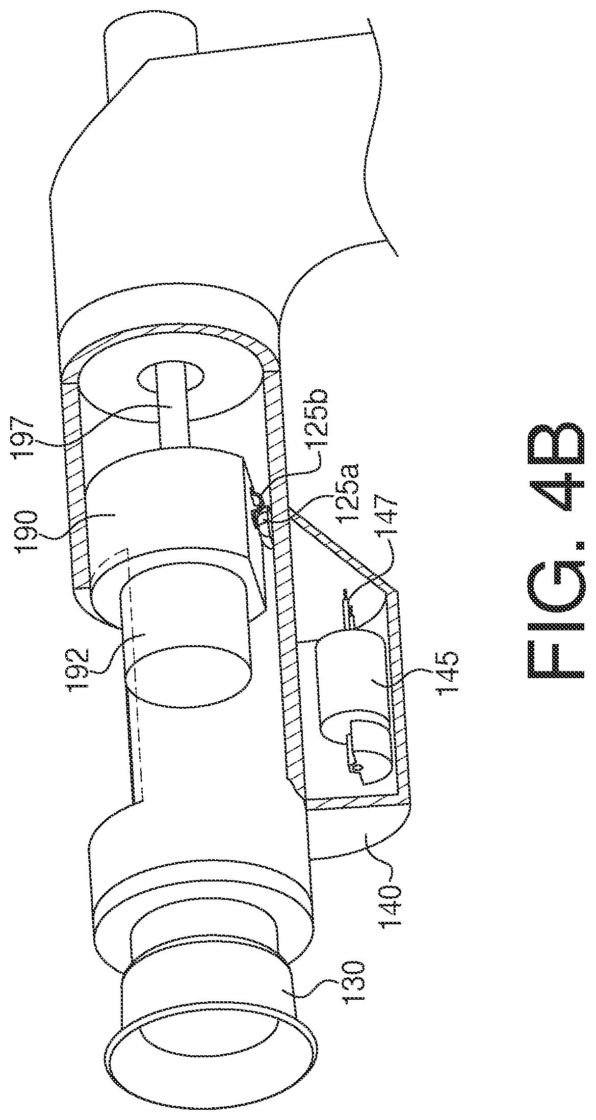 Patent US12102598 Figure 4 – Devices and methods for cornea treatment
