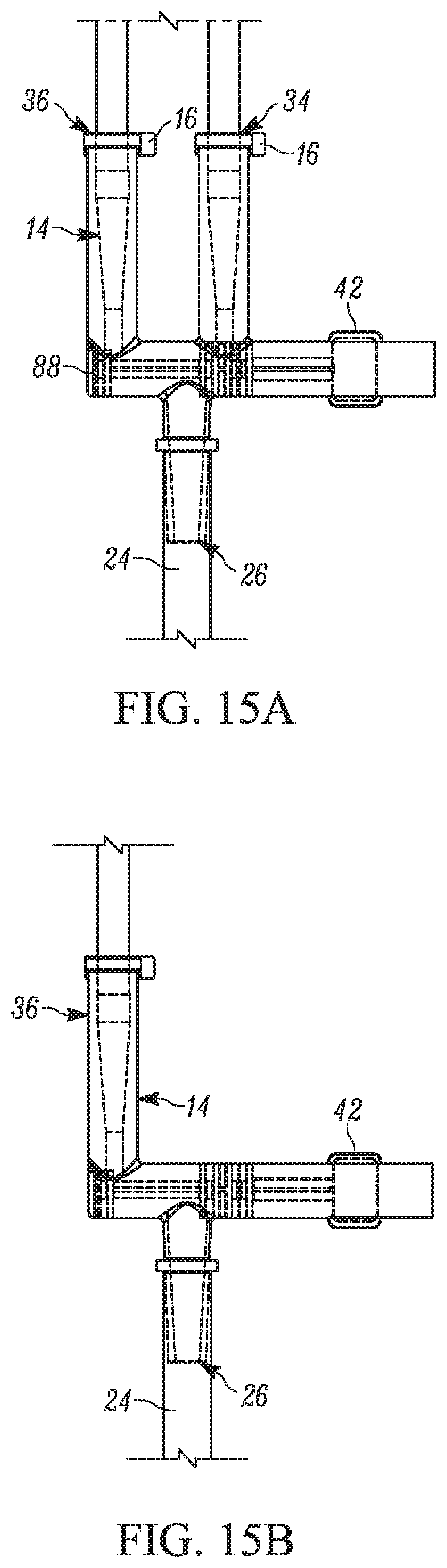 Patent US12102600 Figure 15 – Feeding set and enteral feeding pump assembly