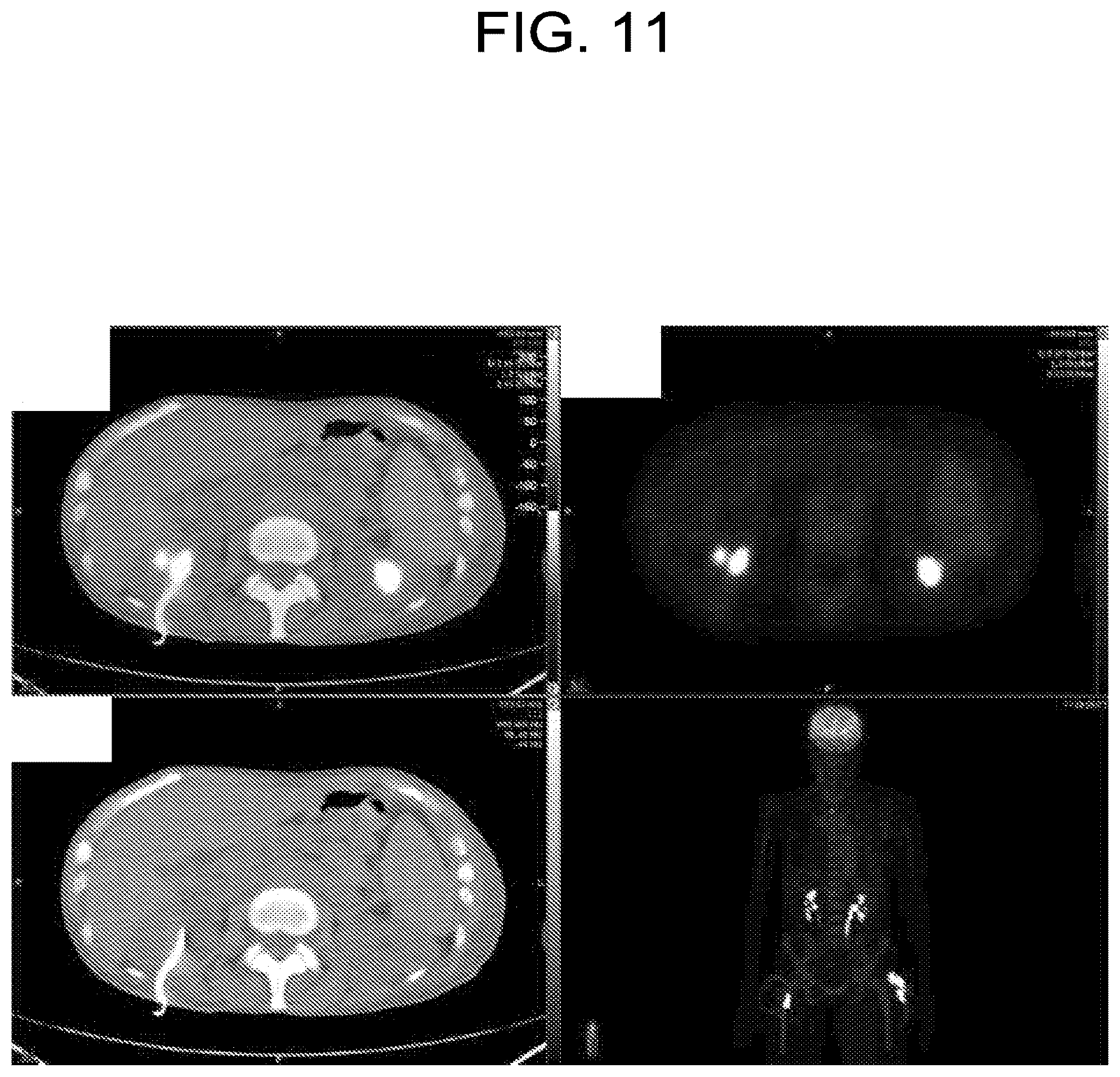 Patent US12102613 Figure 12 – Compositions, methods, systems and/or kits for preventing and/or treating neoplasms