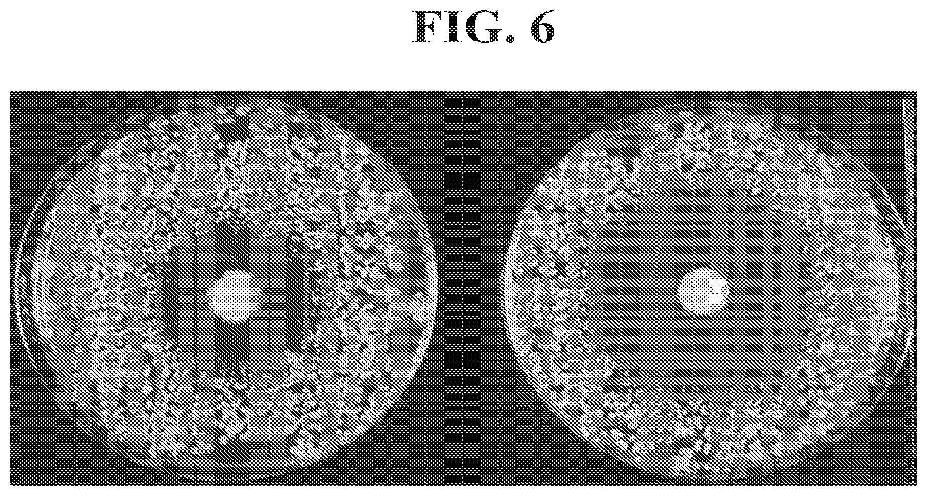 Patent US12102617 Figure 6 – Antimicrobial compositions containing a synergistic combination of activated creatinine and an imidazole antifungal agent
