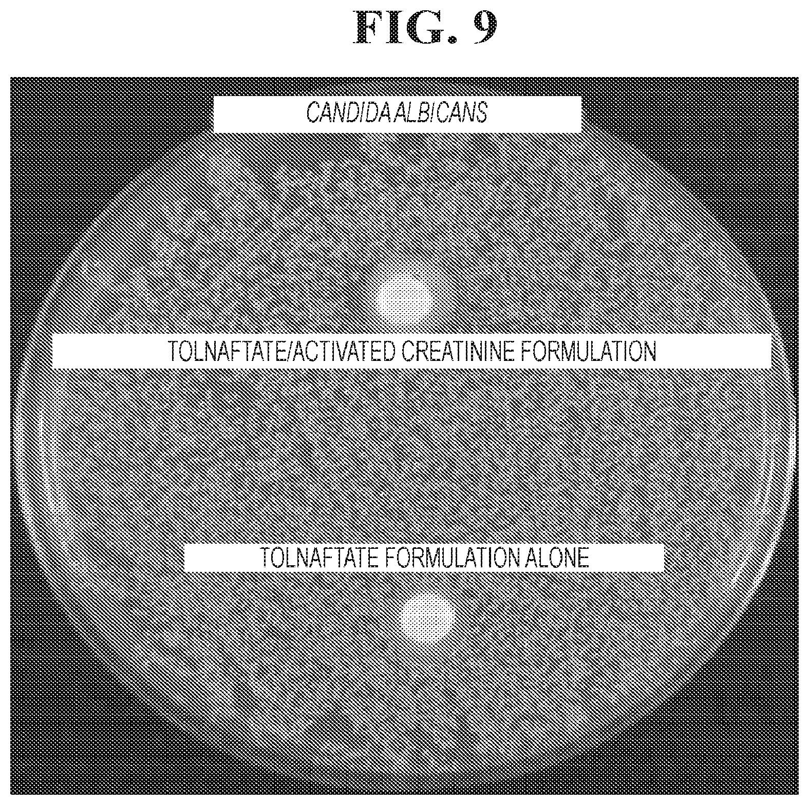 Patent US12102617 Figure 9 – Antimicrobial compositions containing a synergistic combination of activated creatinine and an imidazole antifungal agent