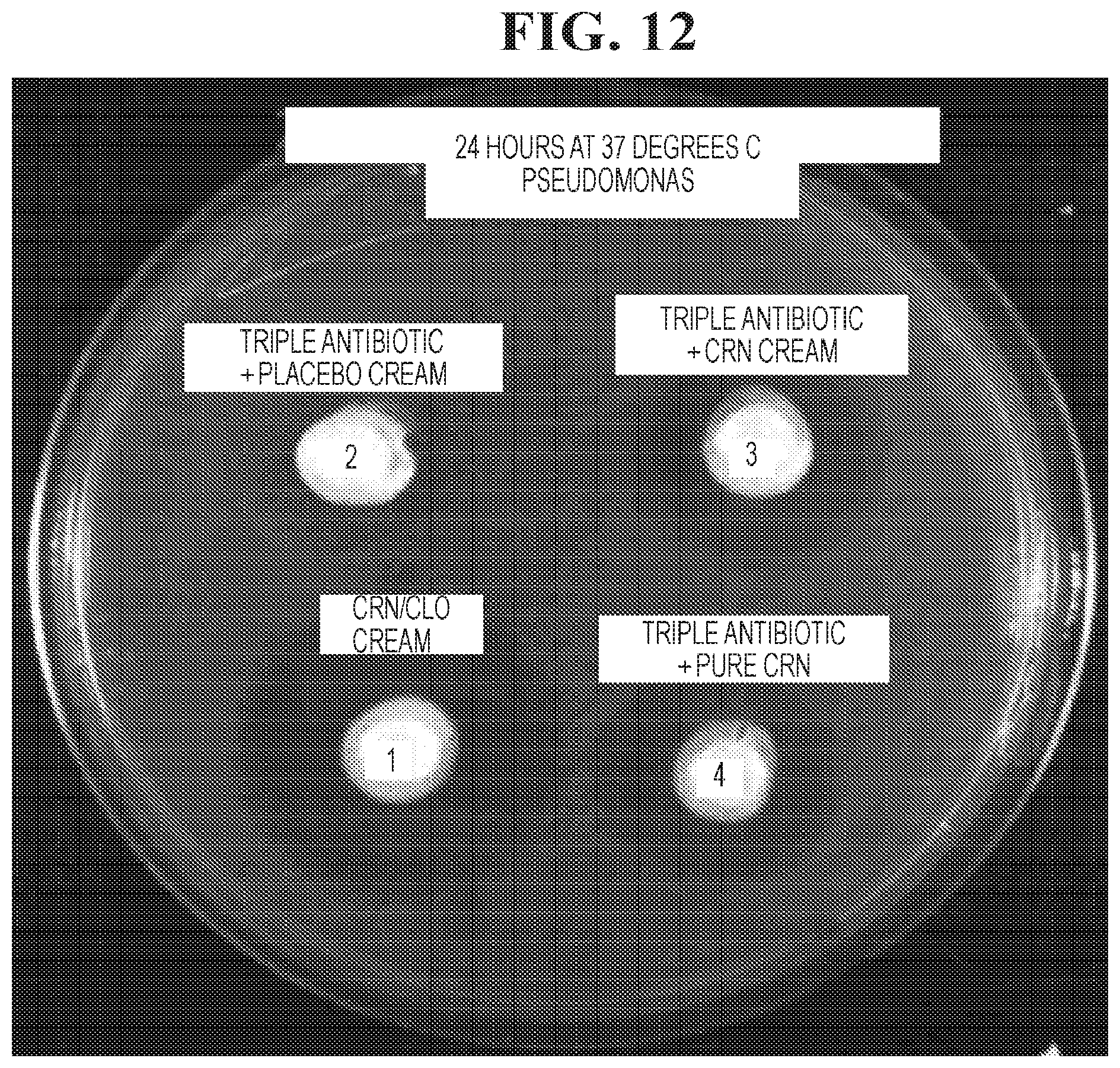 Patent US12102617 Figure 12 – Antimicrobial compositions containing a synergistic combination of activated creatinine and an imidazole antifungal agent