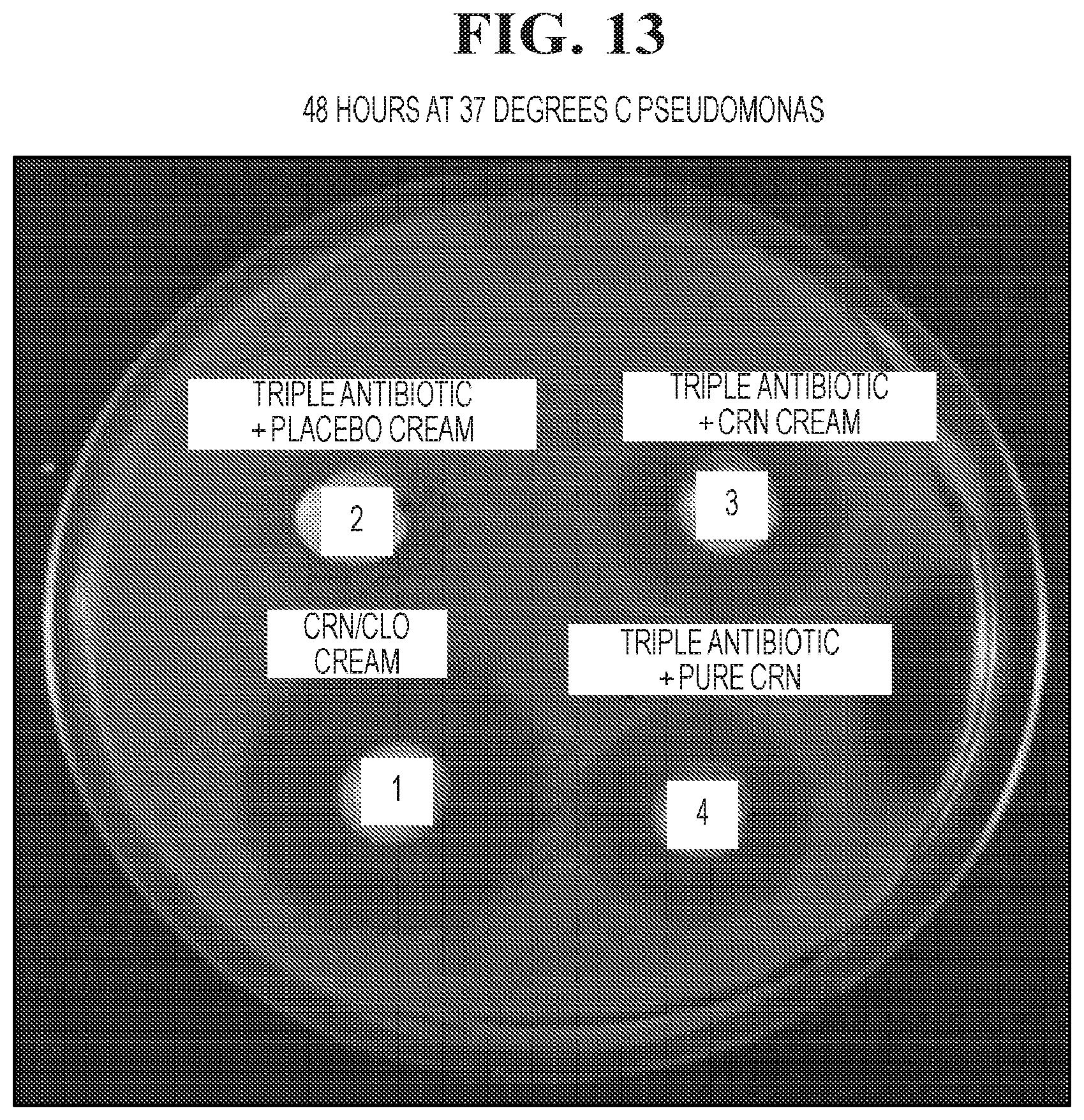 Patent US12102617 Figure 13 – Antimicrobial compositions containing a synergistic combination of activated creatinine and an imidazole antifungal agent