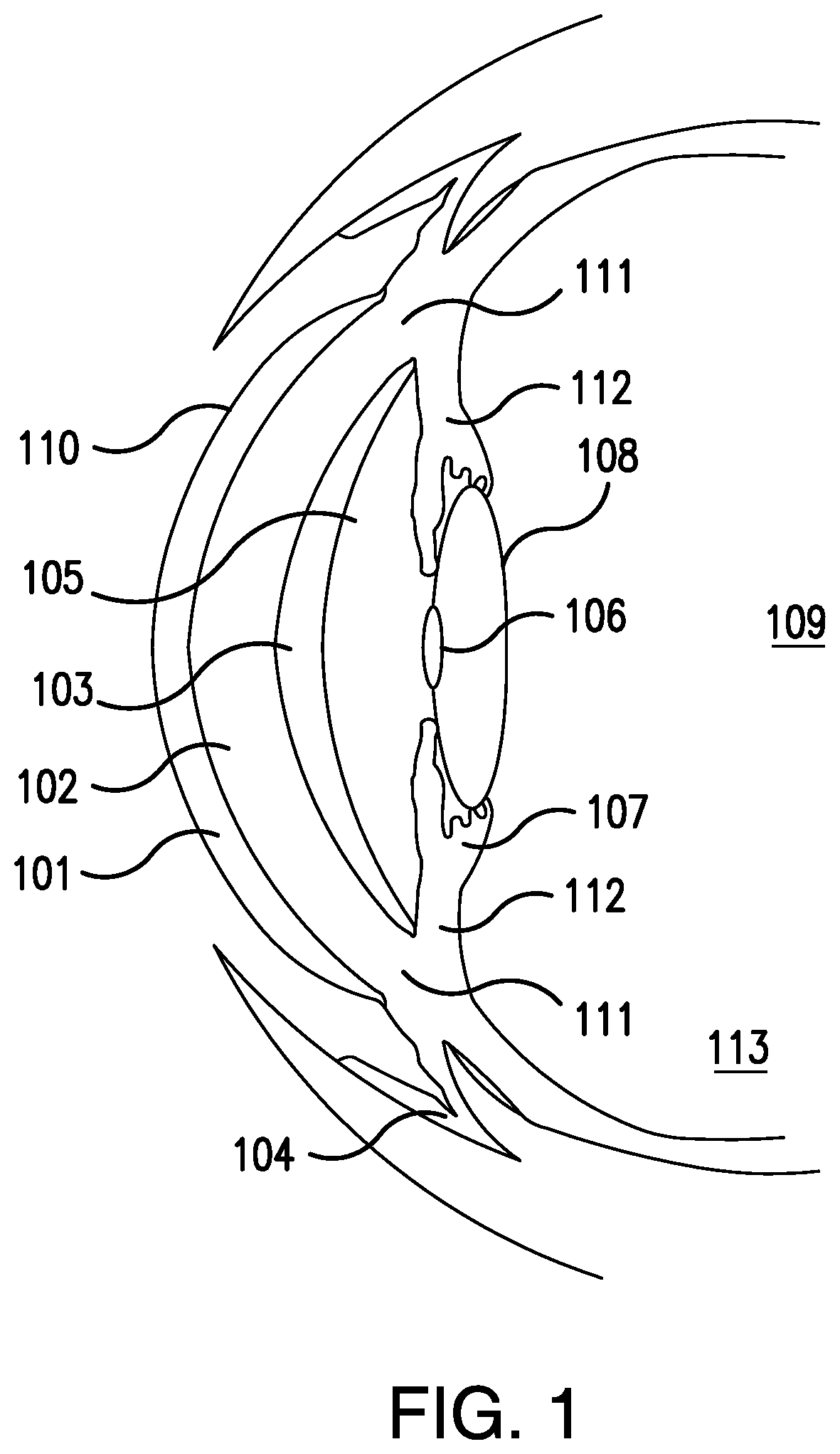 Patent US12102622 Figure 1 – Methods for ophthalmic delivery of roflumilast