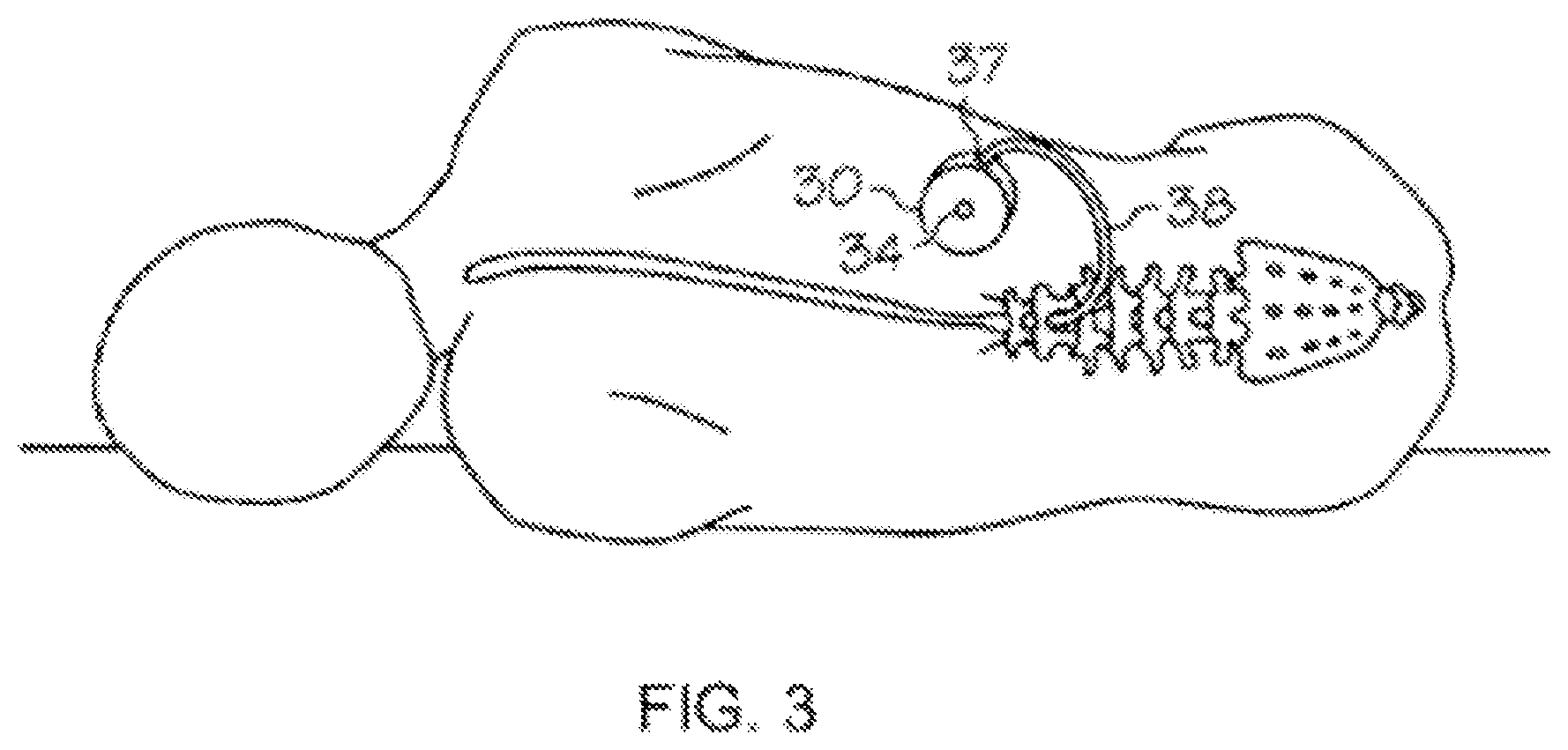 Patent US12102636 Figure 3 – Administration of antipsychotics