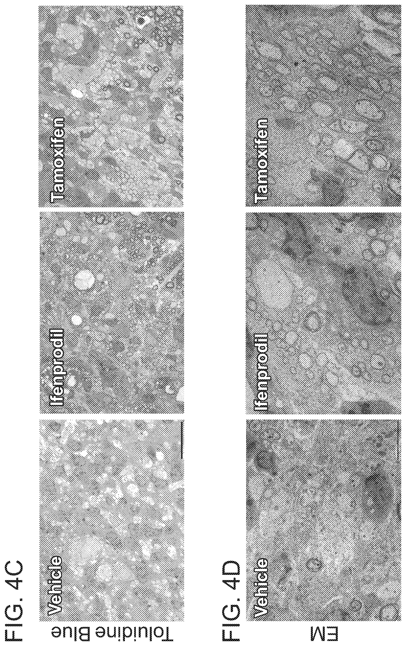 Patent US12102644 Figure 17 – Compounds and methods of promoting myelination