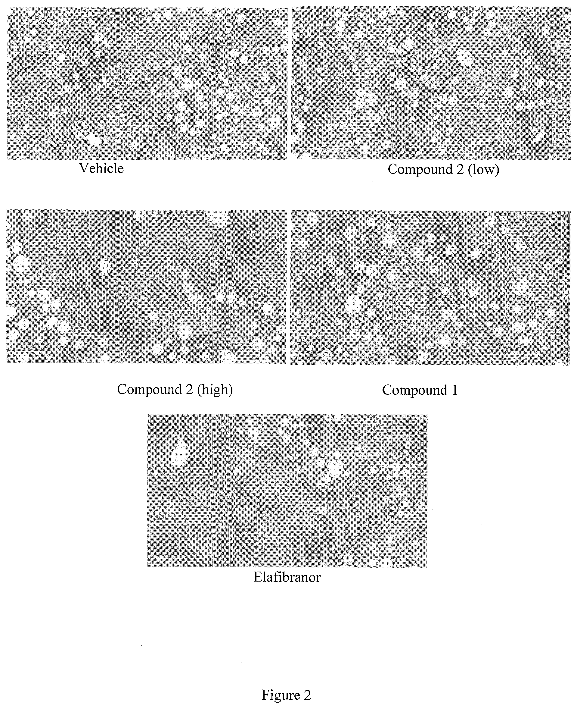 Patent US12102646 Figure 2 – Compositions for the treatment of fibrosis and inflammation