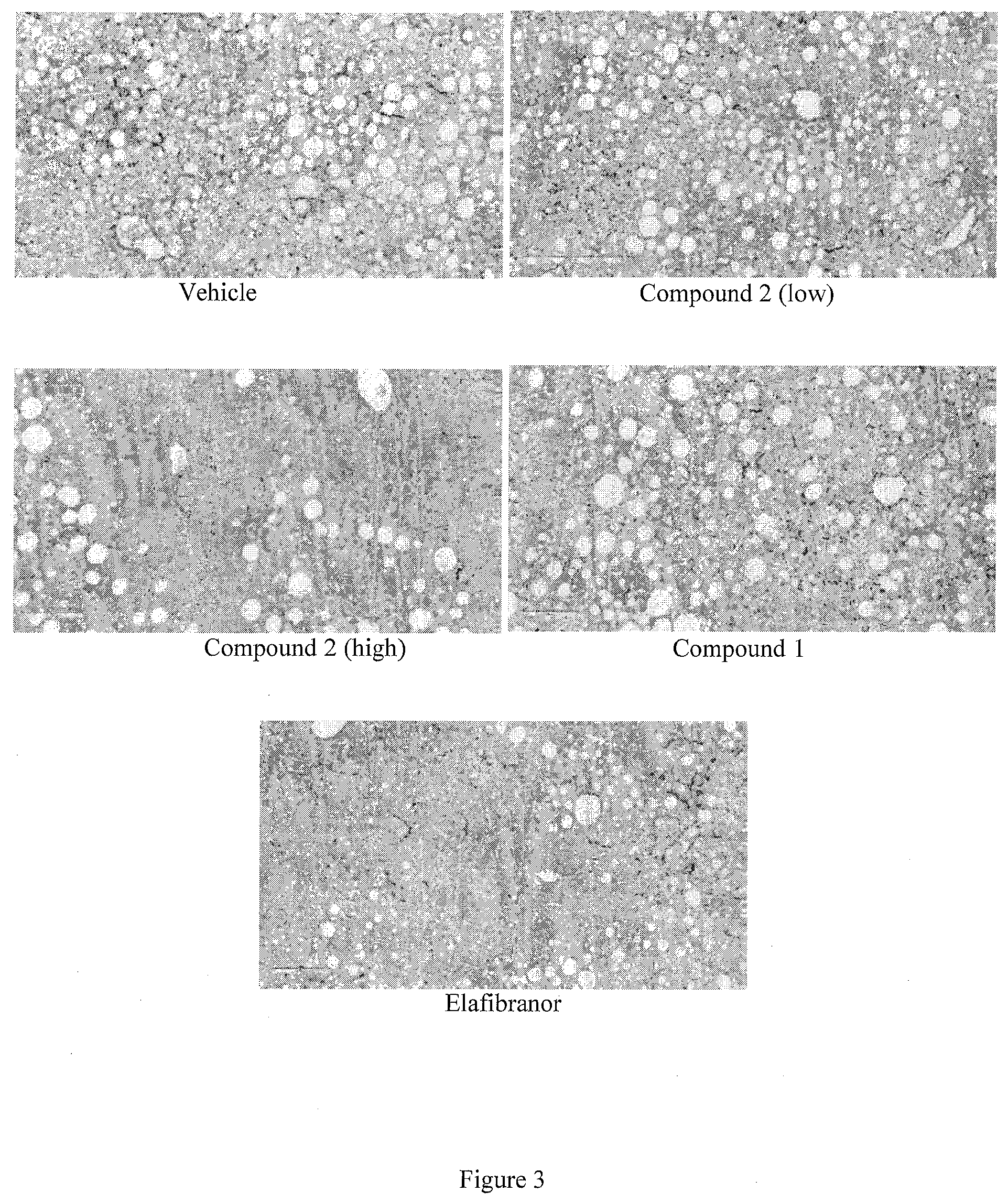 Patent US12102646 Figure 3 – Compositions for the treatment of fibrosis and inflammation