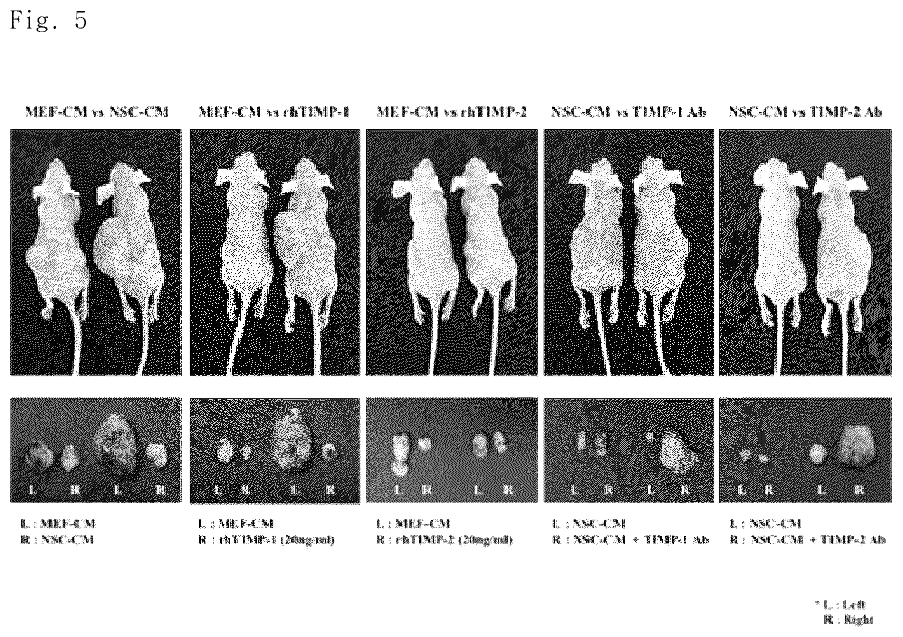Patent US12102669 Figure 5 – Compositions for inhibiting teratoma formation and growth comprising TIMP-1 and TIMP-2 as effective components