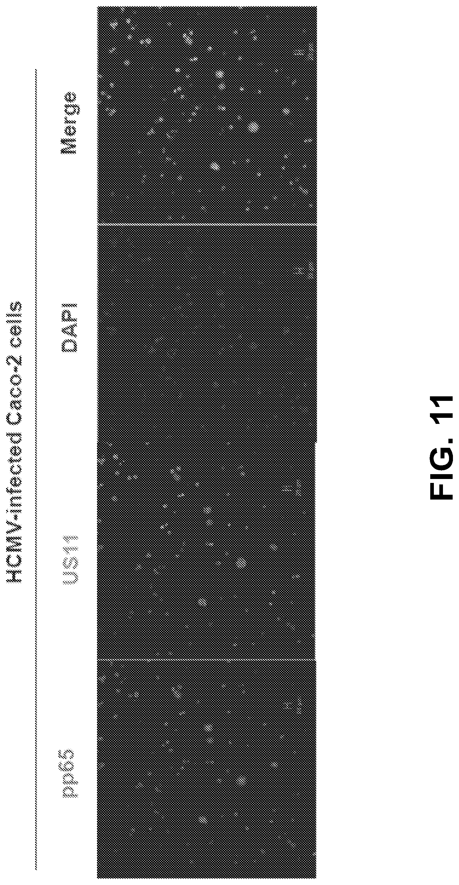 Patent US12102679 Figure 17 – FcRn-targeted therapeutics for the treatment of antibody-mediated autoimmune and albumin-mediated disease