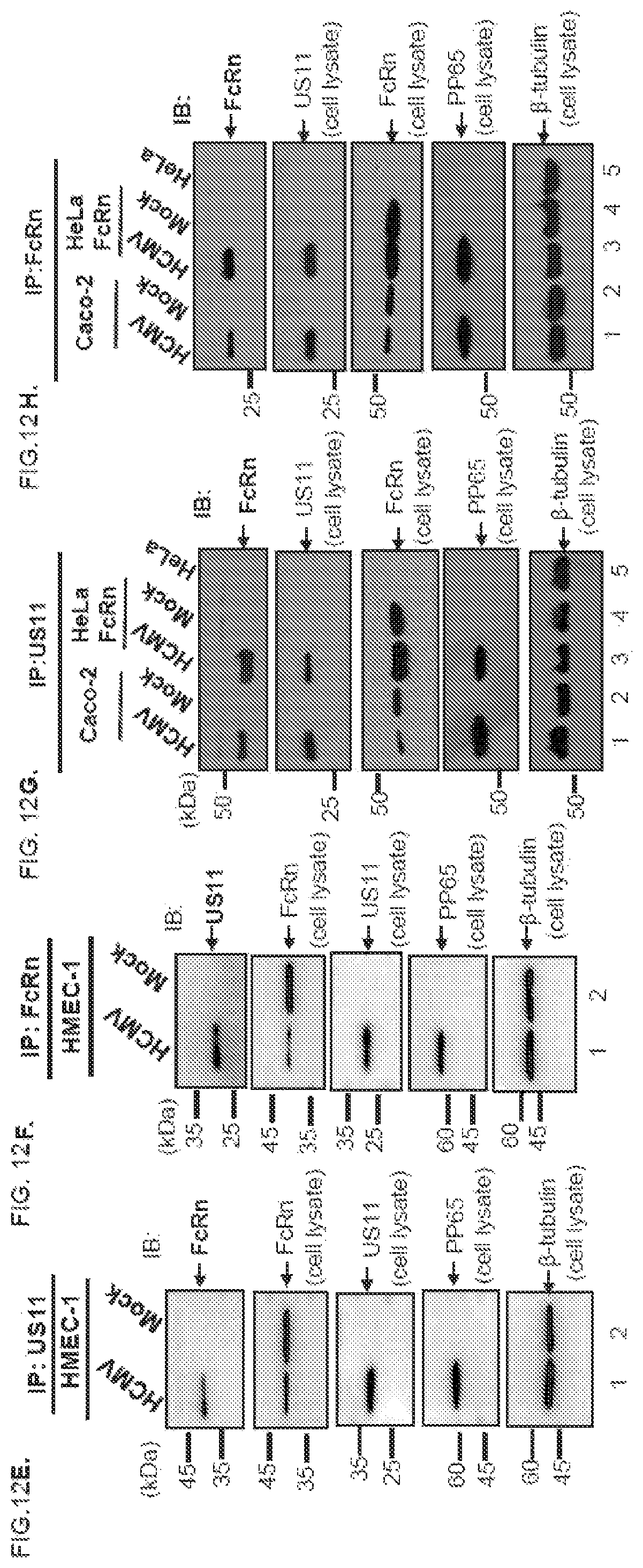 Patent US12102679 Figure 19 – FcRn-targeted therapeutics for the treatment of antibody-mediated autoimmune and albumin-mediated disease