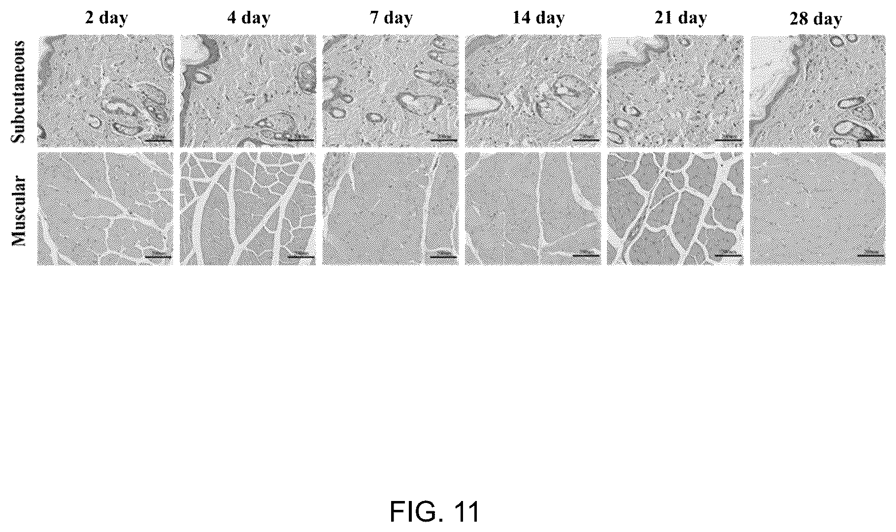 Patent US12102682 Figure 11 – Injectable photothermal hydrogel based on melanin, preparation method, and application thereof