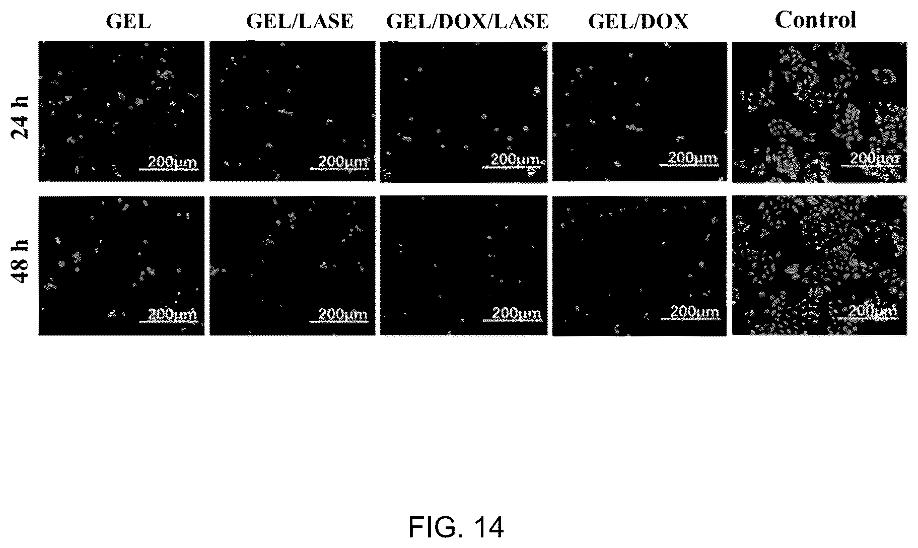 Patent US12102682 Figure 14 – Injectable photothermal hydrogel based on melanin, preparation method, and application thereof