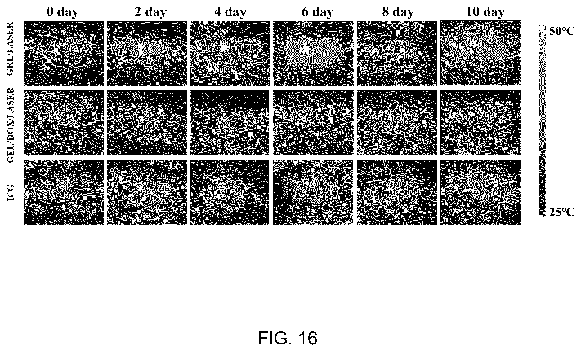 Patent US12102682 Figure 16 – Injectable photothermal hydrogel based on melanin, preparation method, and application thereof