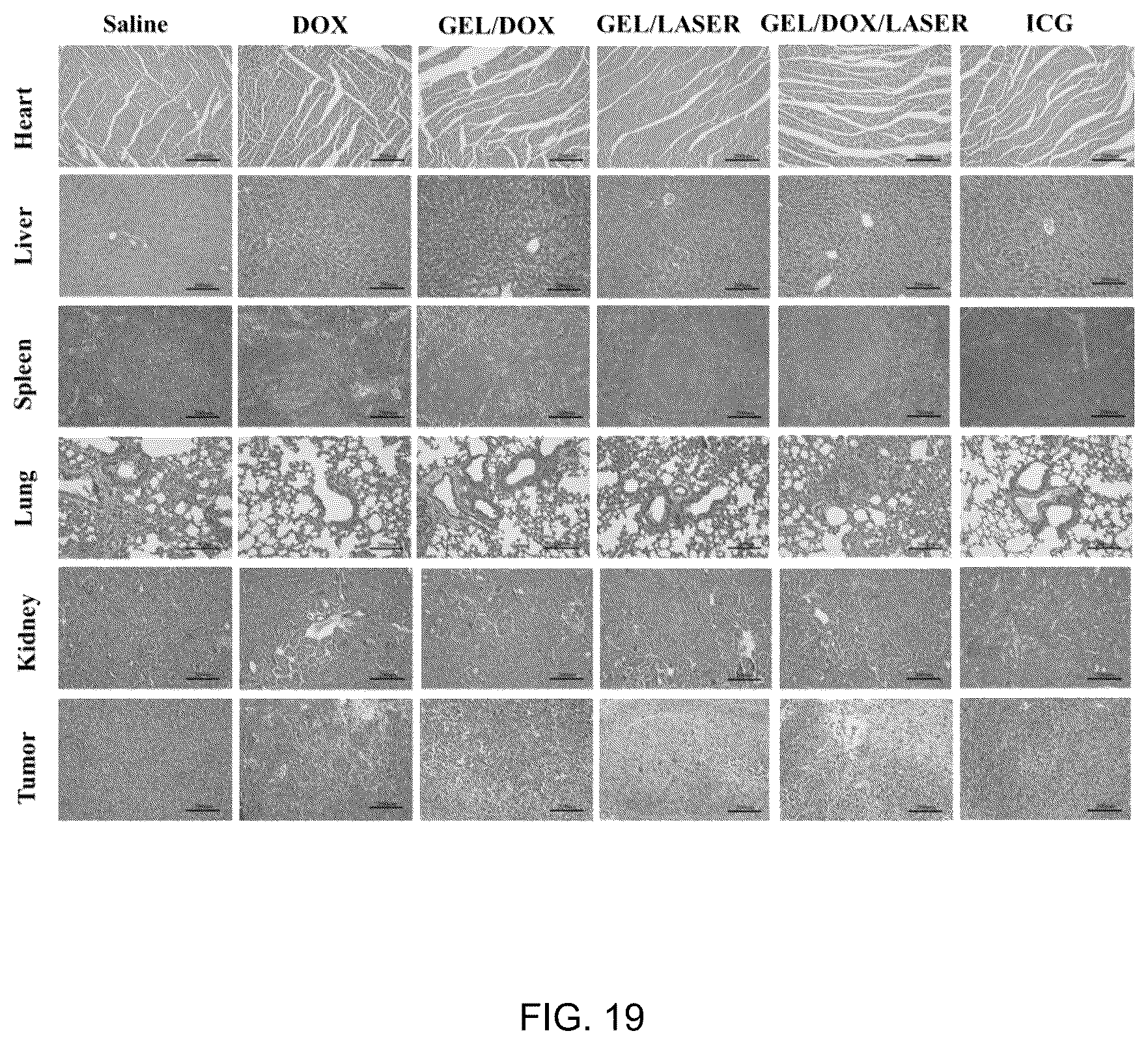 Patent US12102682 Figure 19 – Injectable photothermal hydrogel based on melanin, preparation method, and application thereof