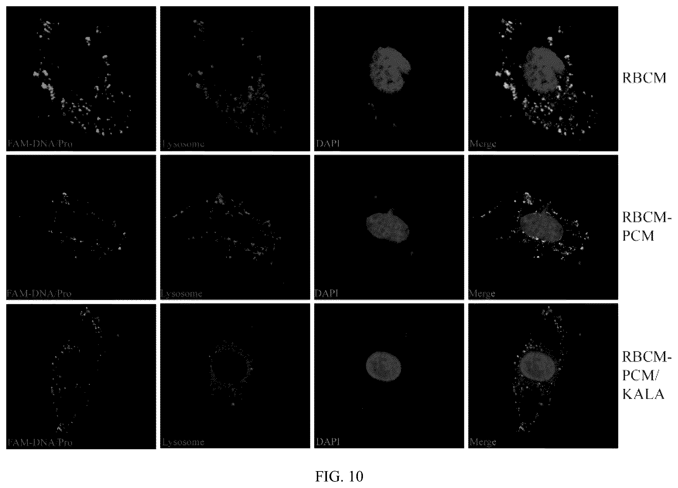 Patent US12102690 Figure 7 – Preparation method and application of biomimetic nano-protectant for detoxifying dox-induced cardiac and systemic toxicity