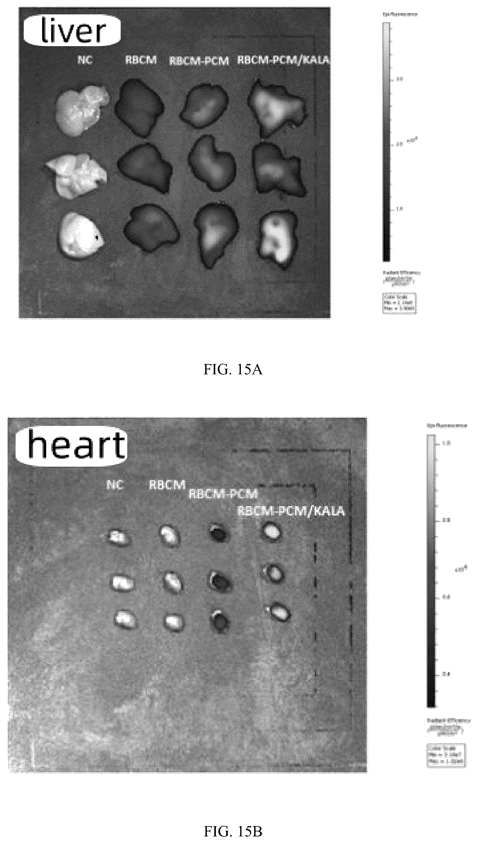 Patent US12102690 Figure 12 – Preparation method and application of biomimetic nano-protectant for detoxifying dox-induced cardiac and systemic toxicity