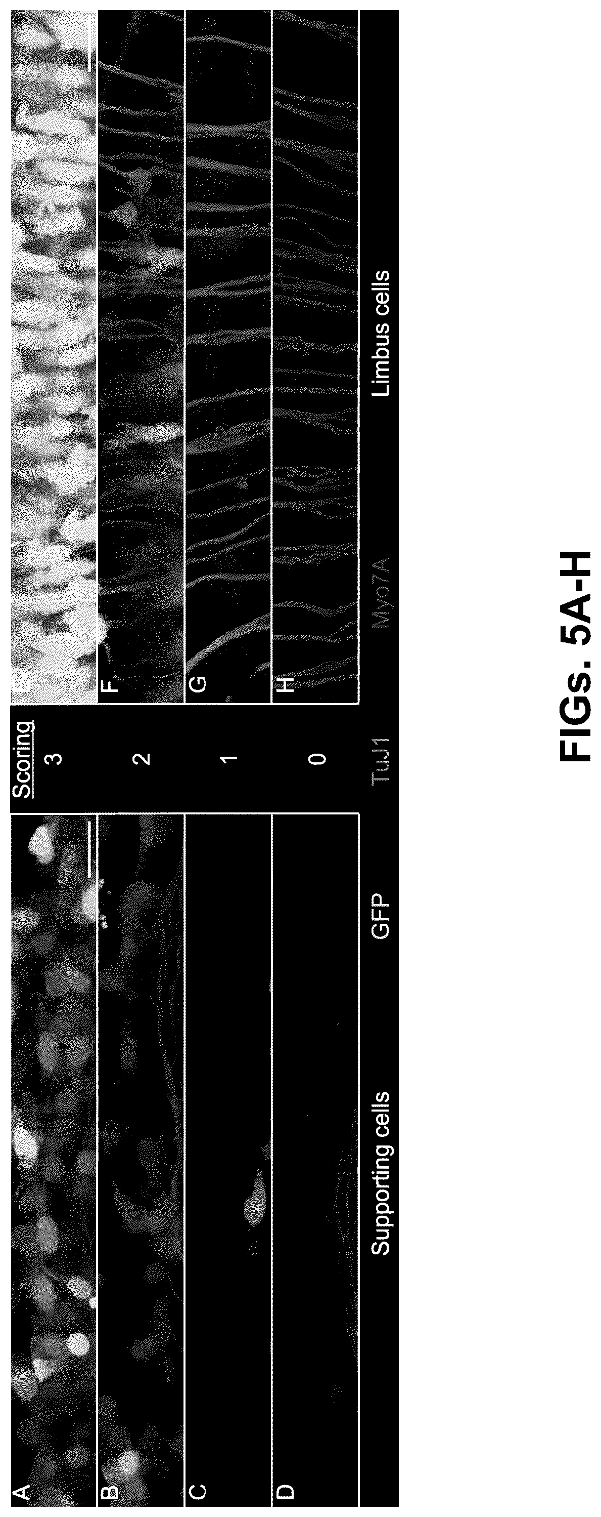 Patent US12102692 Figure 5 – Materials and methods for delivering nucleic acids to cochlear and vestibular cells