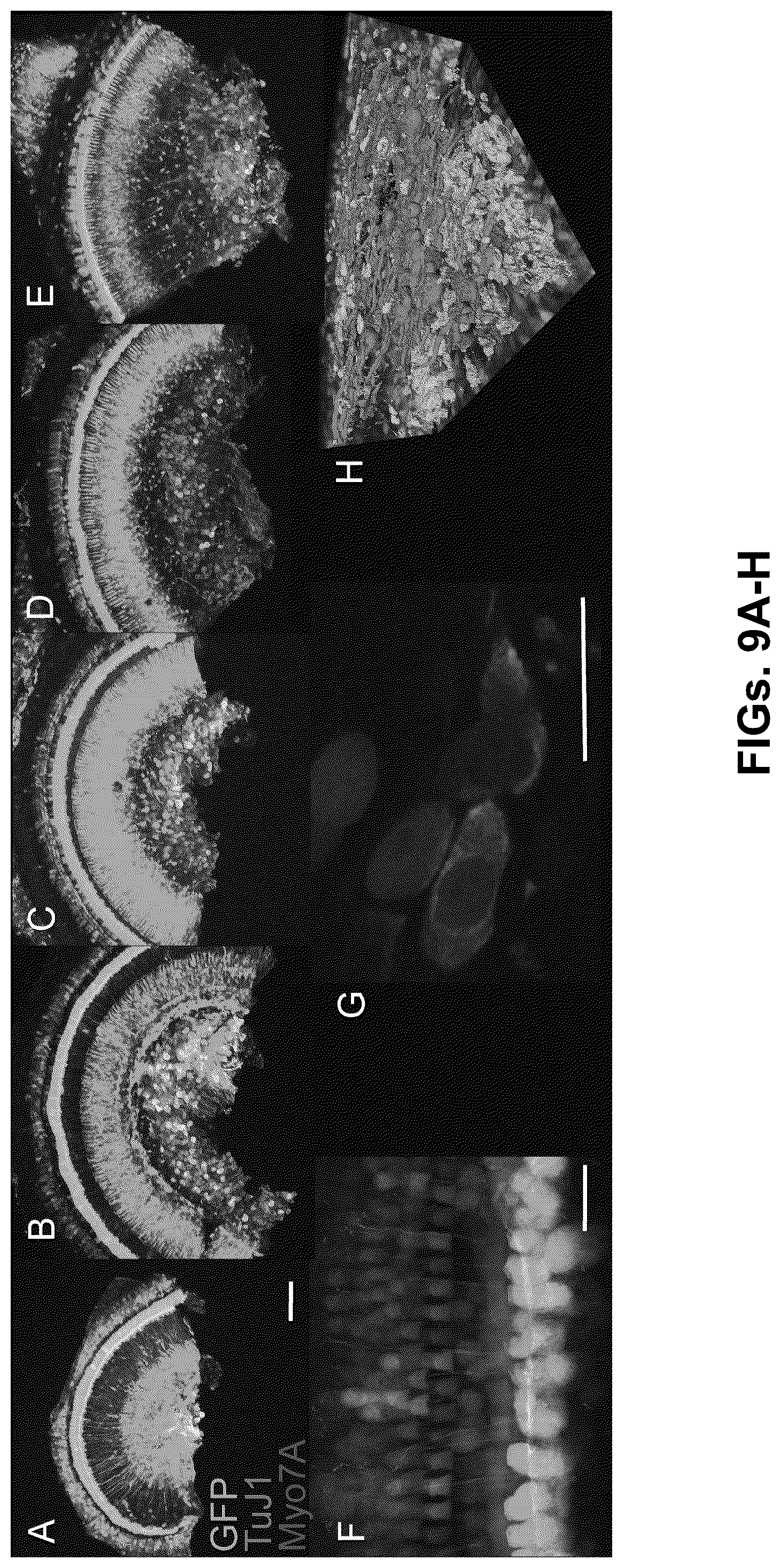 Patent US12102692 Figure 9 – Materials and methods for delivering nucleic acids to cochlear and vestibular cells