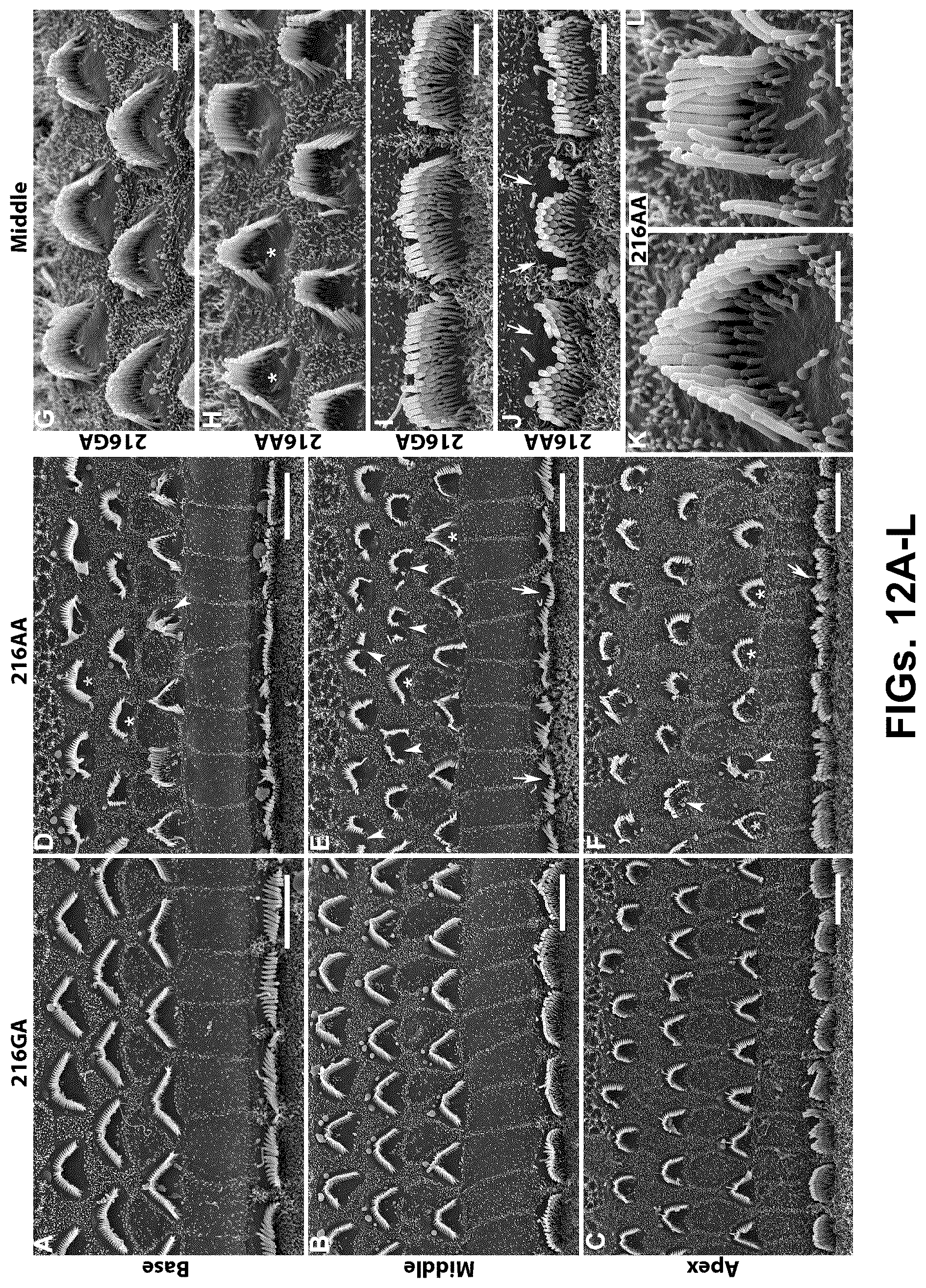 Patent US12102692 Figure 12 – Materials and methods for delivering nucleic acids to cochlear and vestibular cells