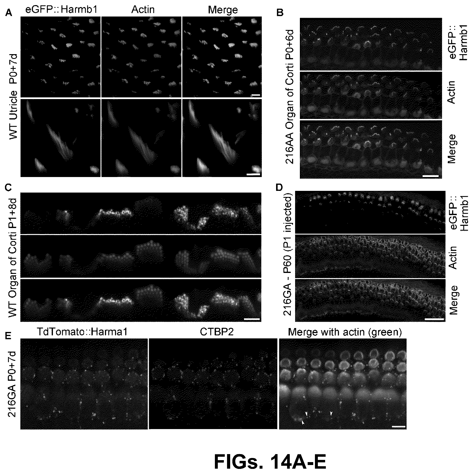 Patent US12102692 Figure 14 – Materials and methods for delivering nucleic acids to cochlear and vestibular cells