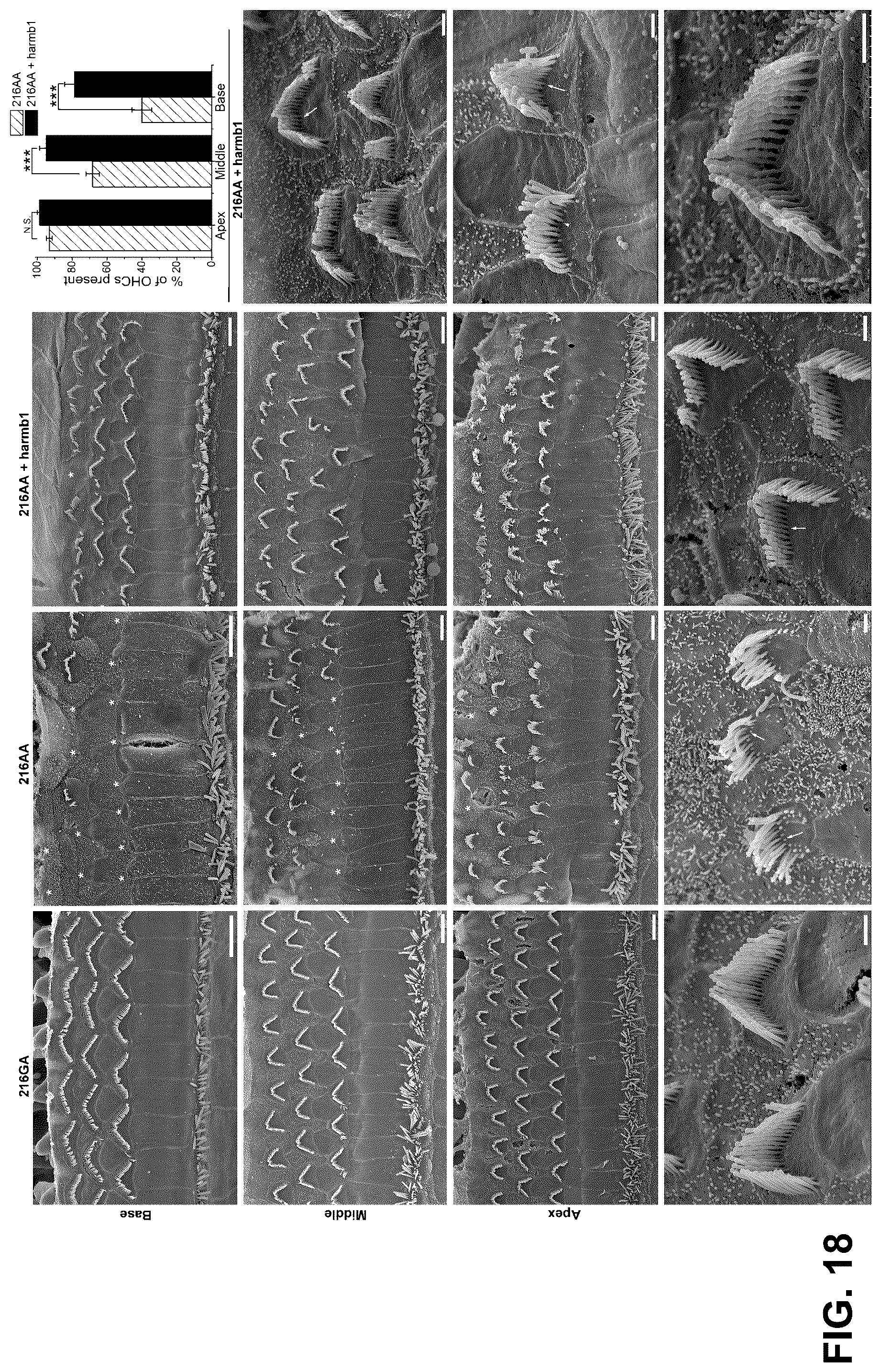 Patent US12102692 Figure 18 – Materials and methods for delivering nucleic acids to cochlear and vestibular cells