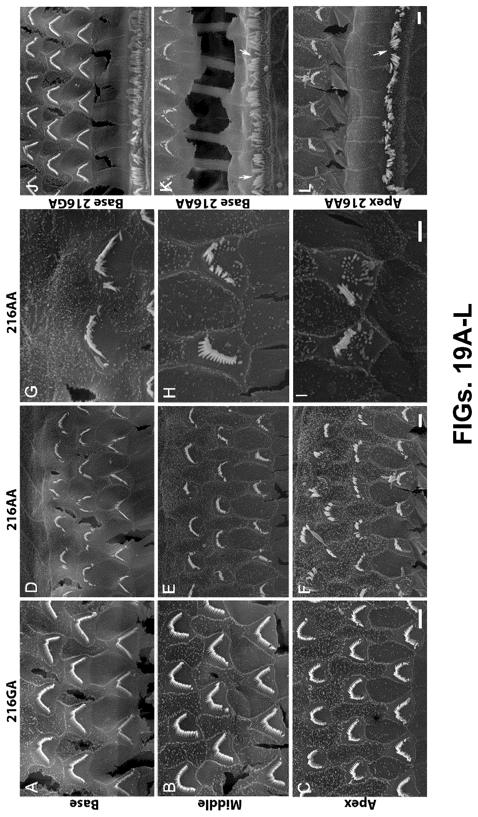 Patent US12102692 Figure 19 – Materials and methods for delivering nucleic acids to cochlear and vestibular cells