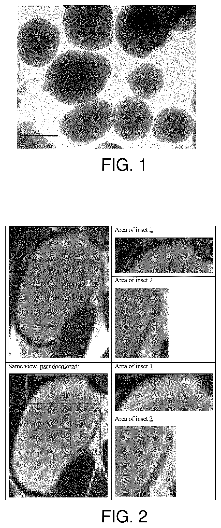Patent US12102693 Figure 1 – Pharmaceutical composition with nanoparticle-based drug delivery combined with non-invasive radiographic monitoring model