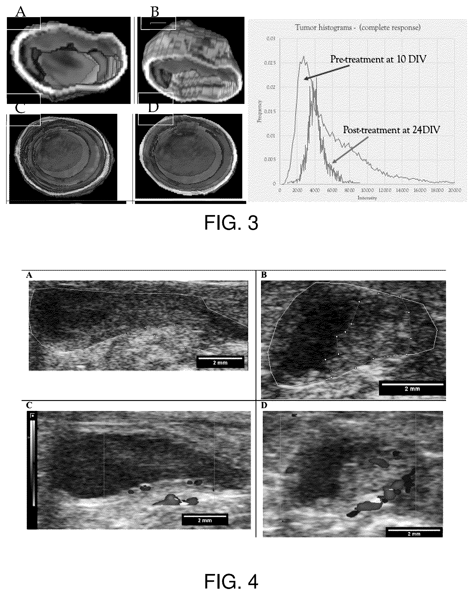 Patent US12102693 Figure 2 – Pharmaceutical composition with nanoparticle-based drug delivery combined with non-invasive radiographic monitoring model