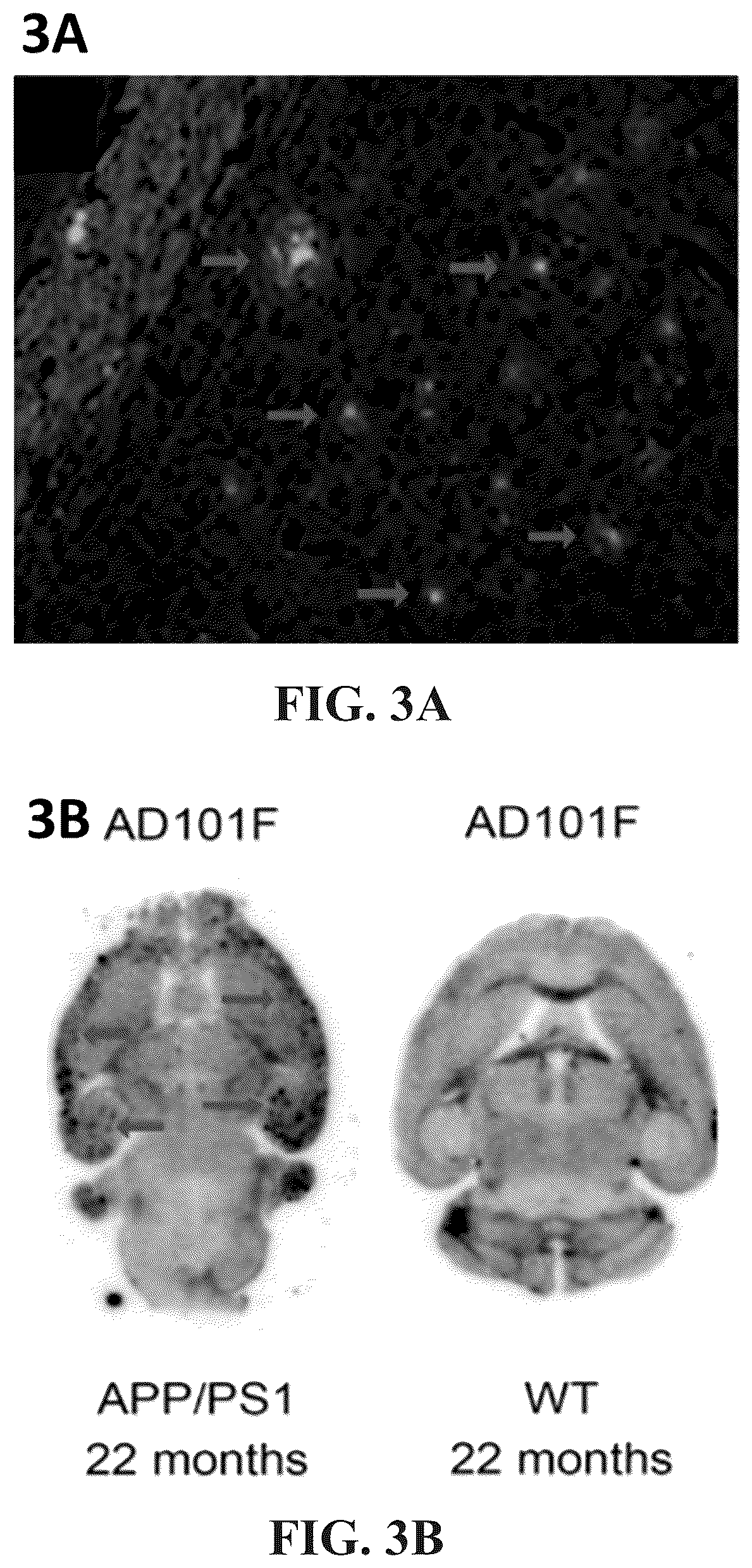 Patent US12102695 Figure 2 – Half-curcuminoids as amyloid-beta pet imaging agents