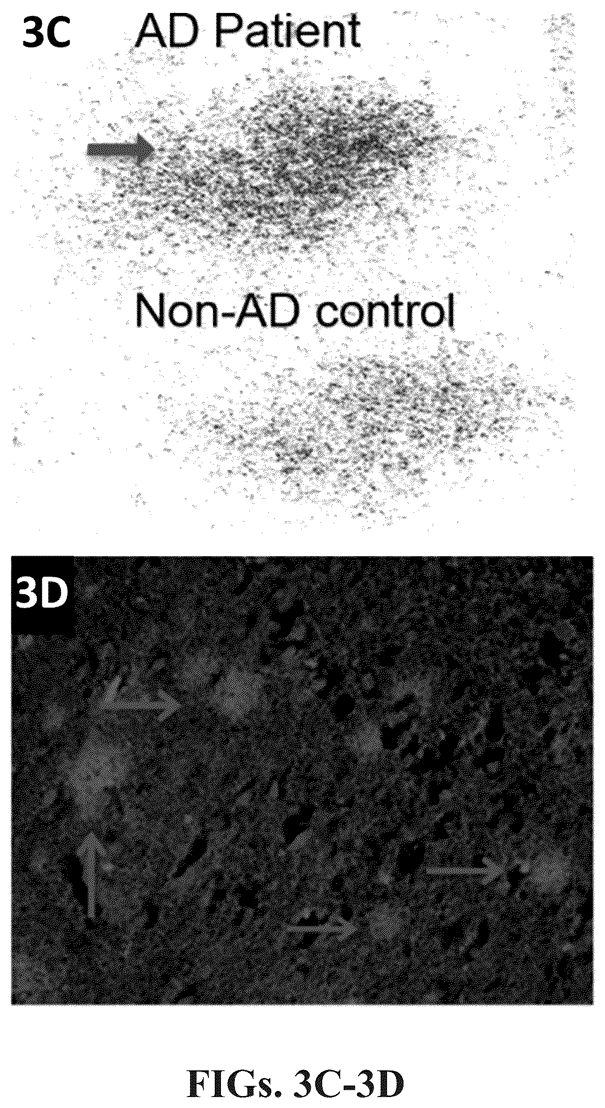 Patent US12102695 Figure 3 – Half-curcuminoids as amyloid-beta pet imaging agents