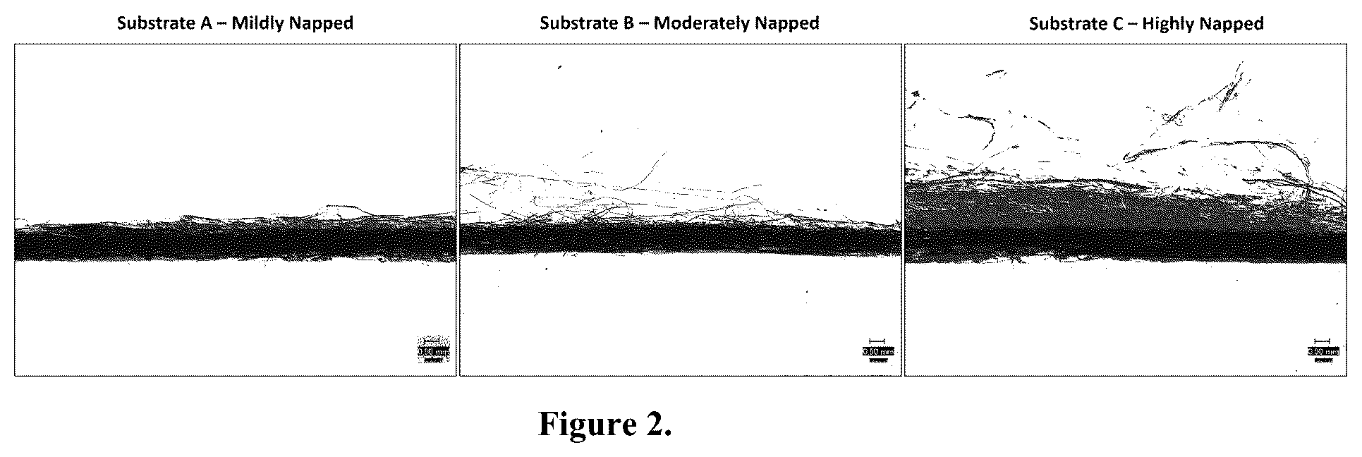 Patent US12102722 Figure 2 – Napped coated wound dressing