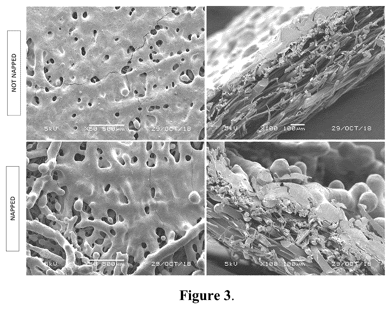 Patent US12102722 Figure 3 – Napped coated wound dressing