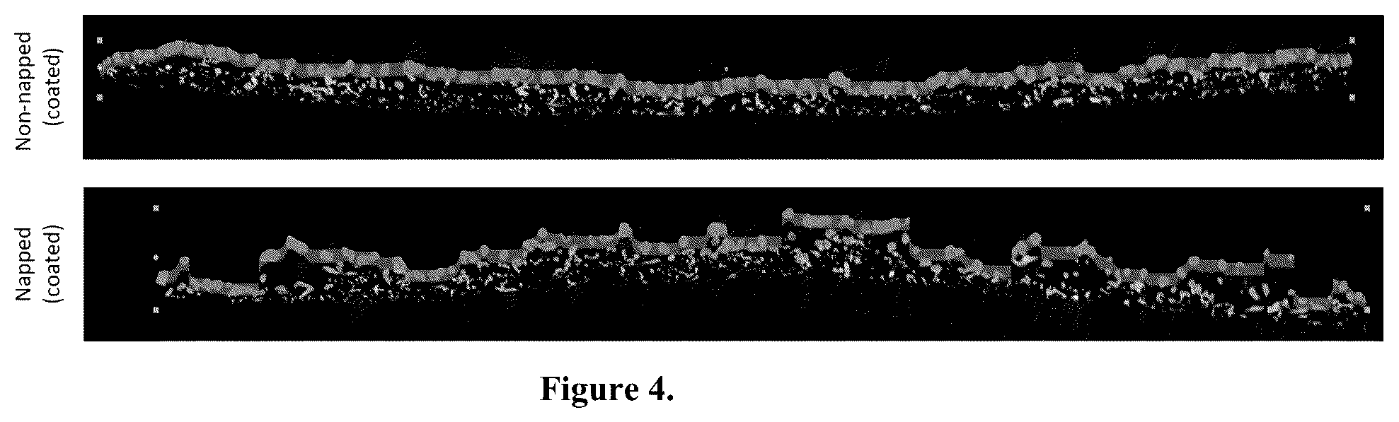 Patent US12102722 Figure 4 – Napped coated wound dressing