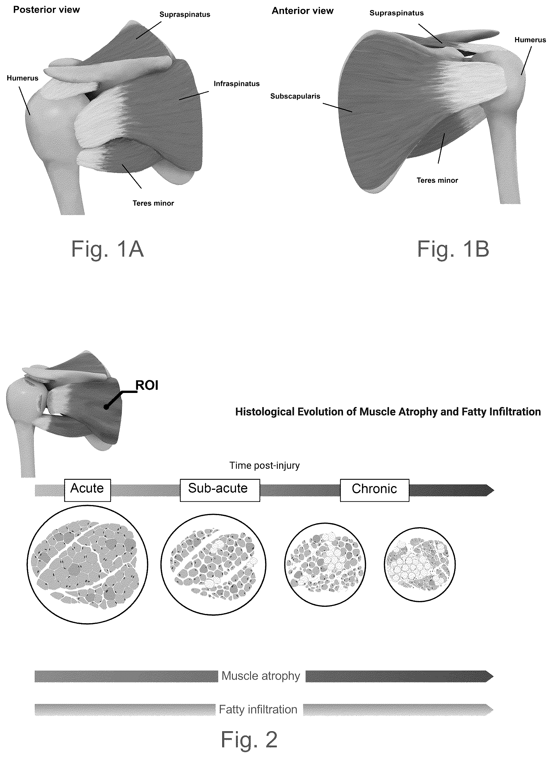 Patent US12102730 Figure 1 – Graphene-based nanofibers for skeletal muscle tissue regeneration