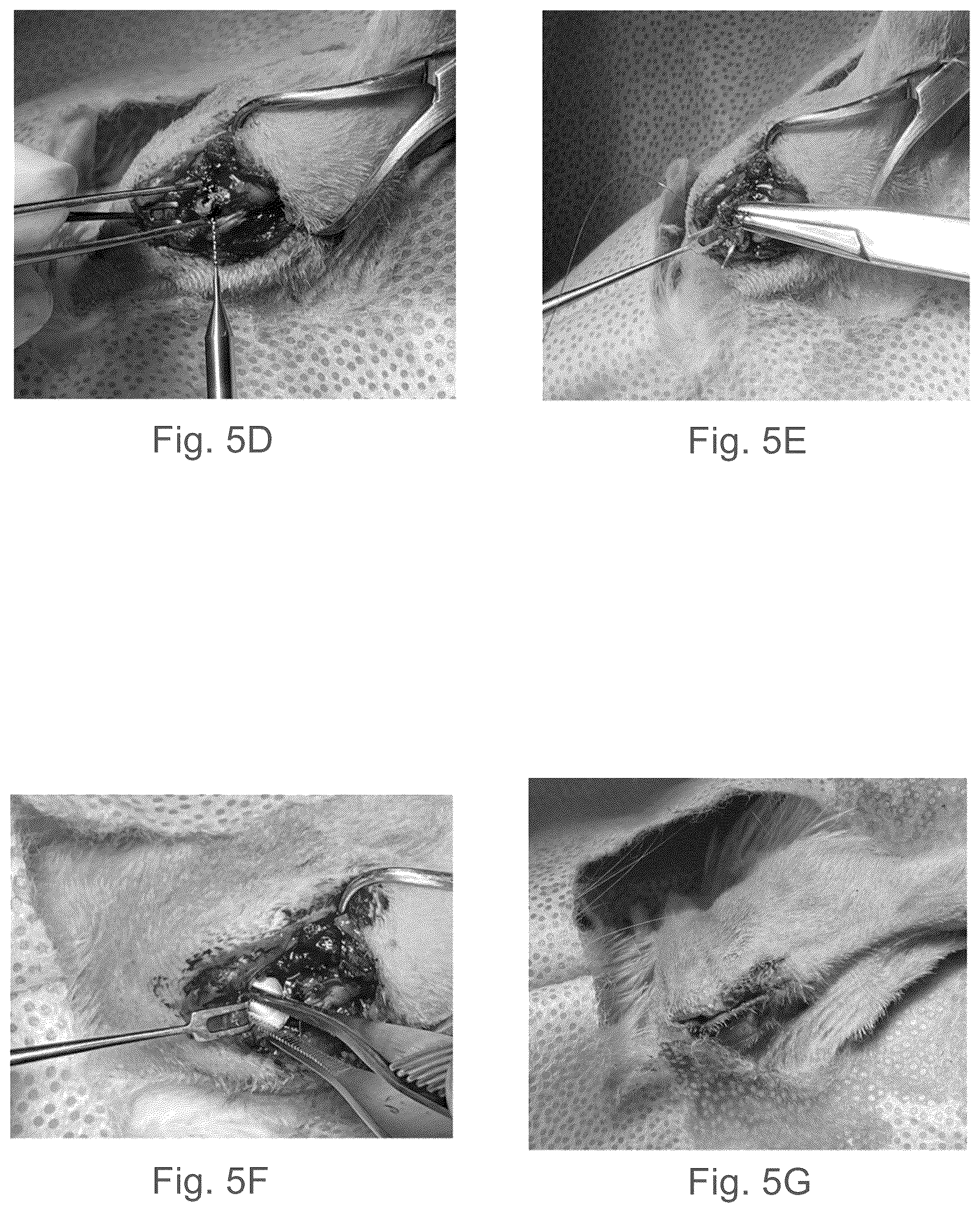 Patent US12102730 Figure 5 – Graphene-based nanofibers for skeletal muscle tissue regeneration
