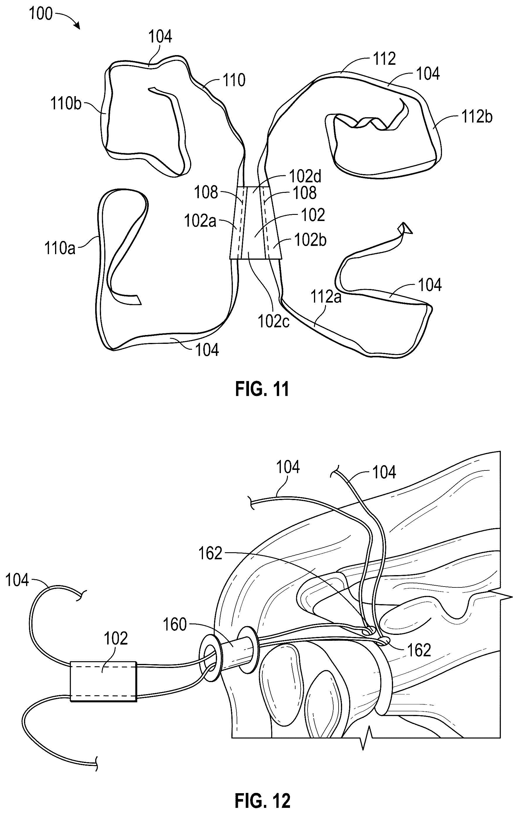 Patent US12102731 Figure 6 – Port-accessible multidirectional reinforced minimally invasive collagen device for soft tissue repair