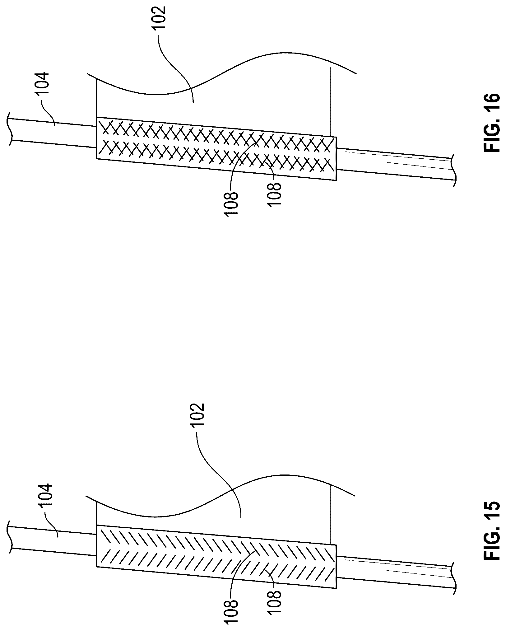 Patent US12102731 Figure 8 – Port-accessible multidirectional reinforced minimally invasive collagen device for soft tissue repair