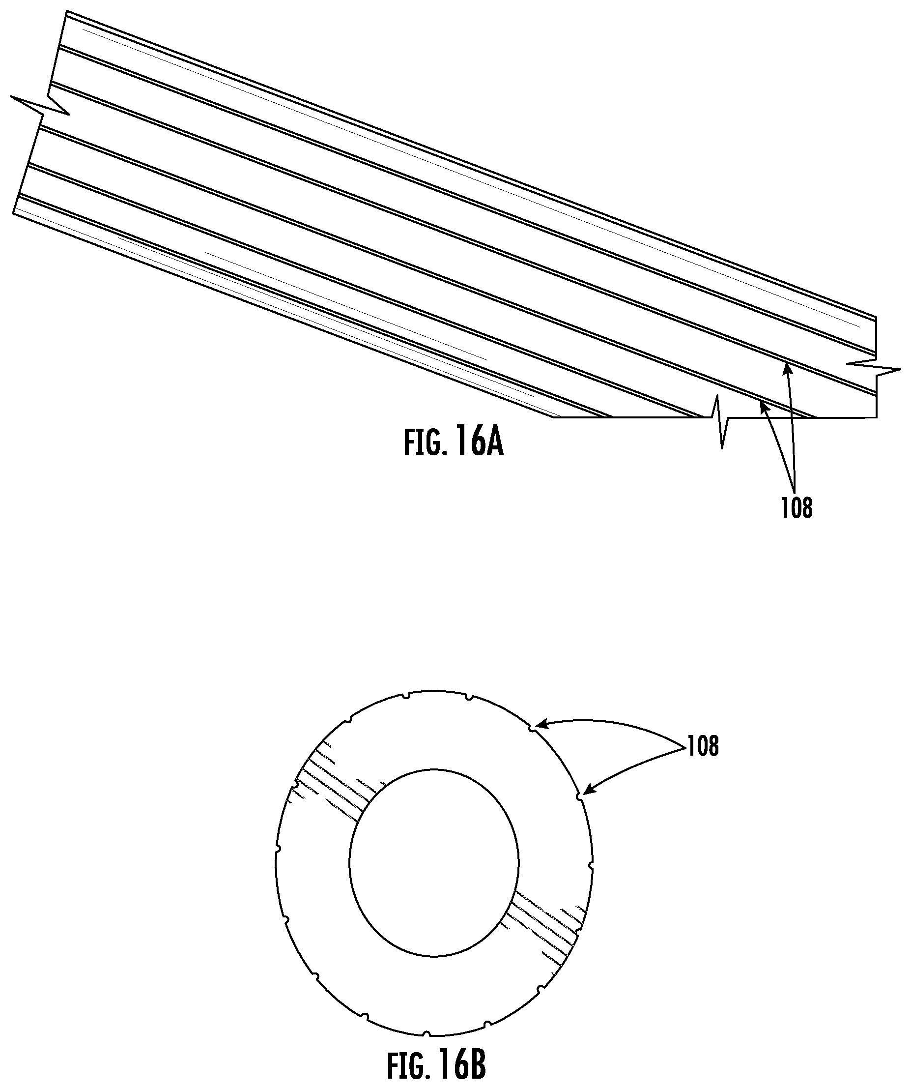 Patent US12102732 Figure 16 – Orthopaedic implant