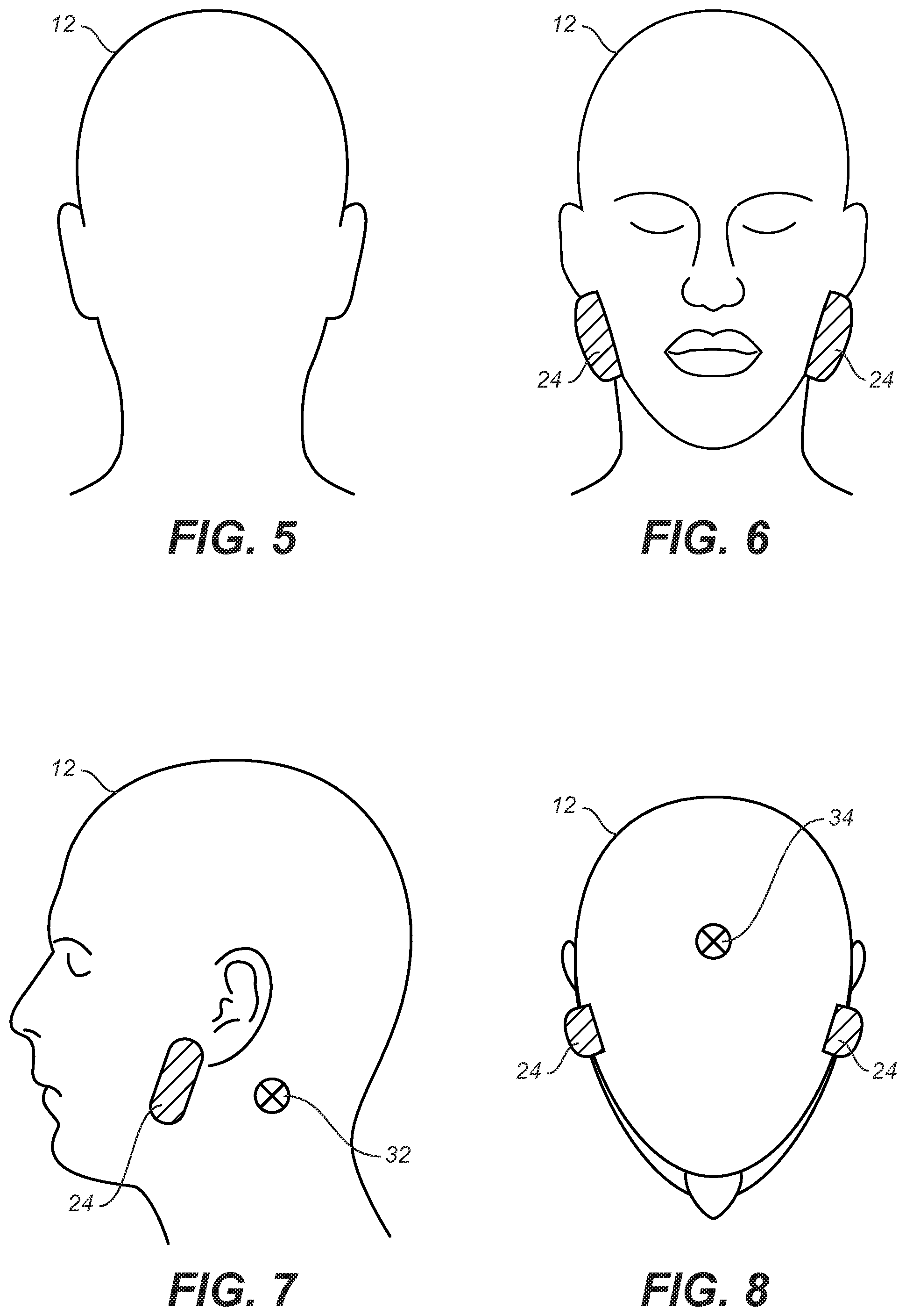 Patent US12102741 Figure 5 – Protective face mask using UVC LEDs
