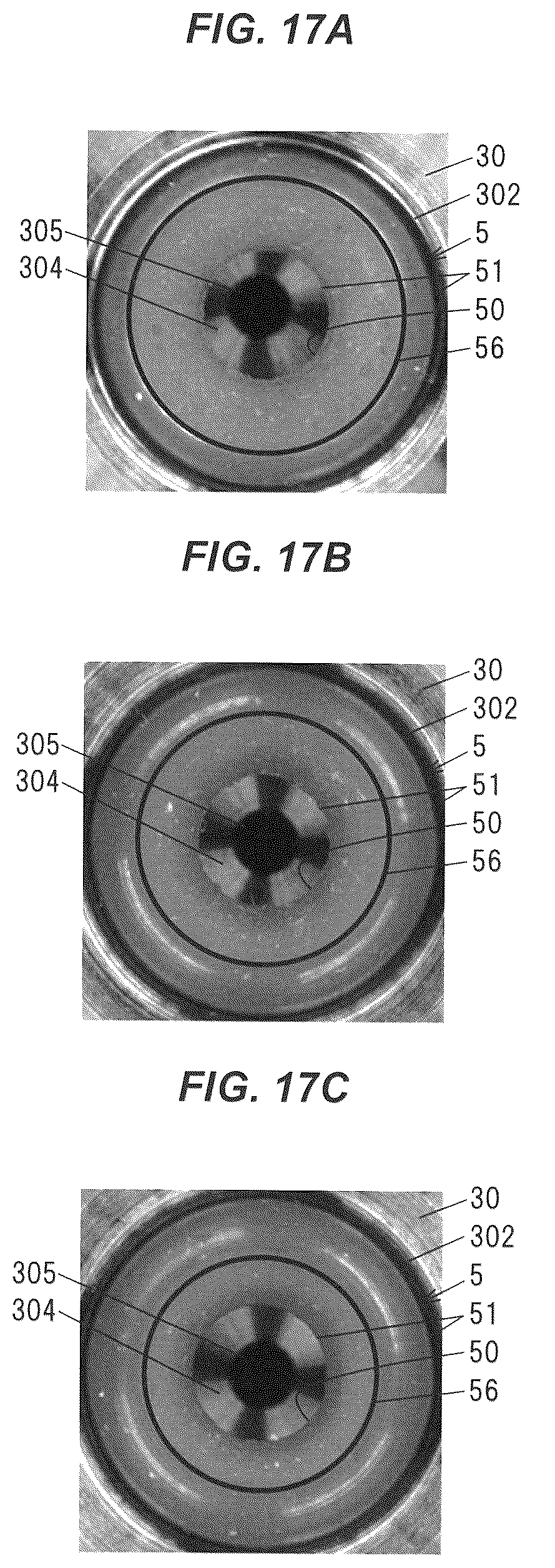 Patent US12102746 Figure 17 – Connection structure and blood purifying device