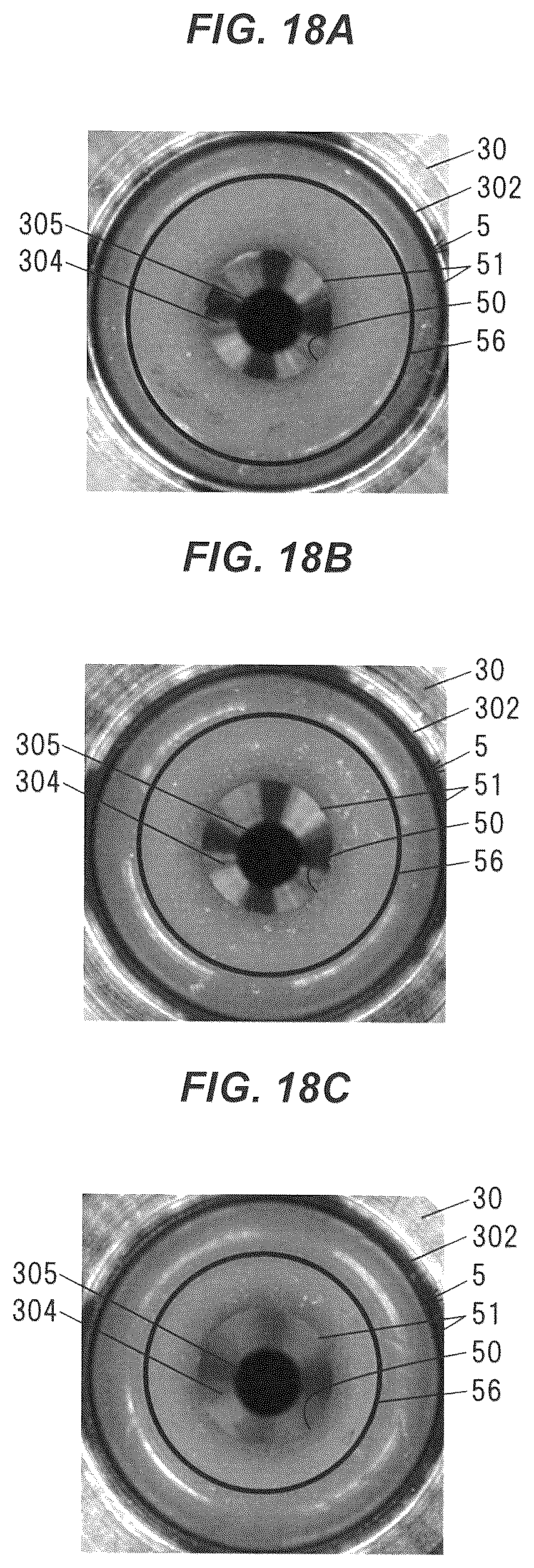 Patent US12102746 Figure 18 – Connection structure and blood purifying device