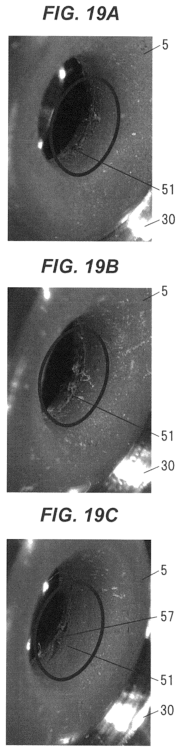 Patent US12102746 Figure 19 – Connection structure and blood purifying device